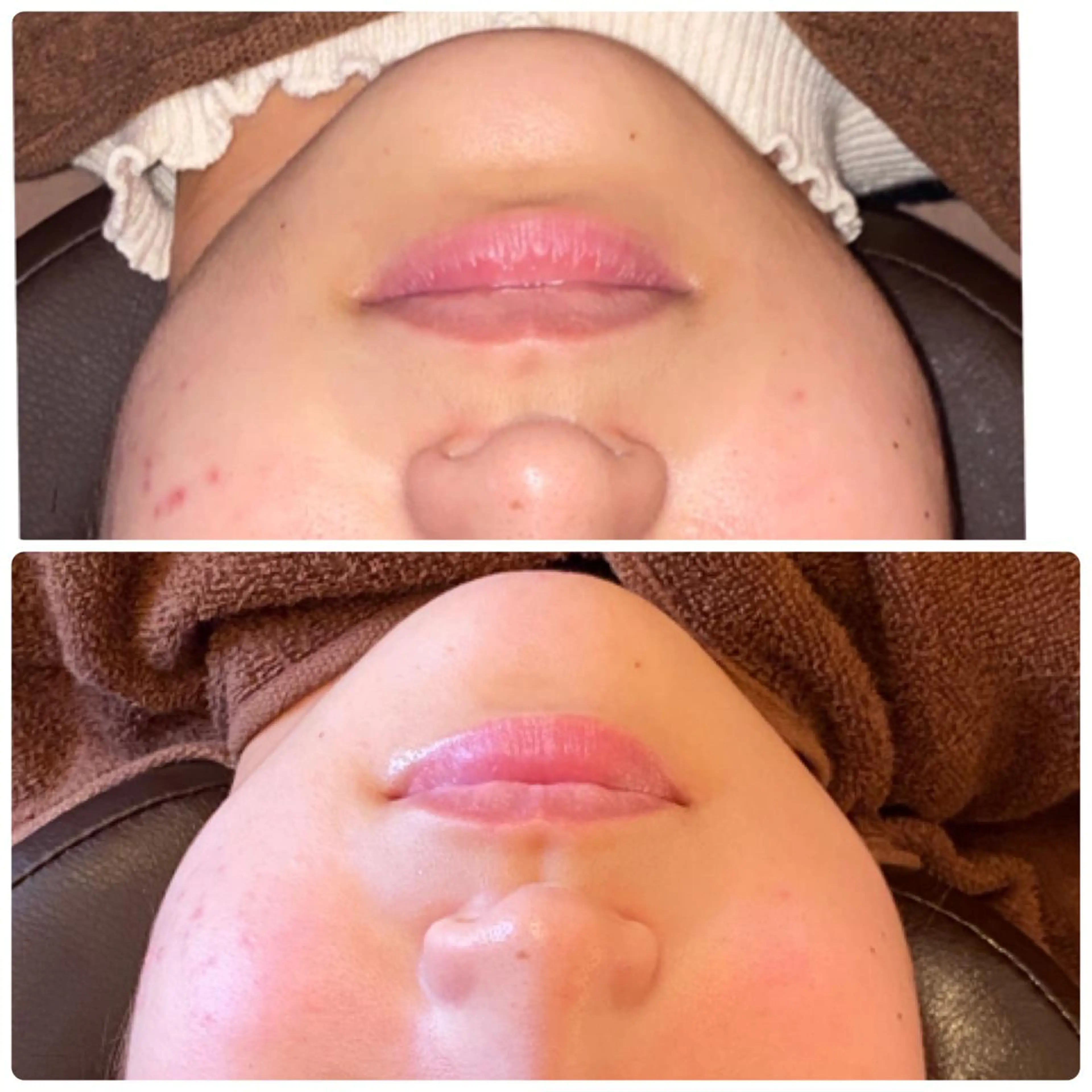 FLEUR大阪・整体 ・ハイフ・痩身・小顔のエステ・リラクイメージ