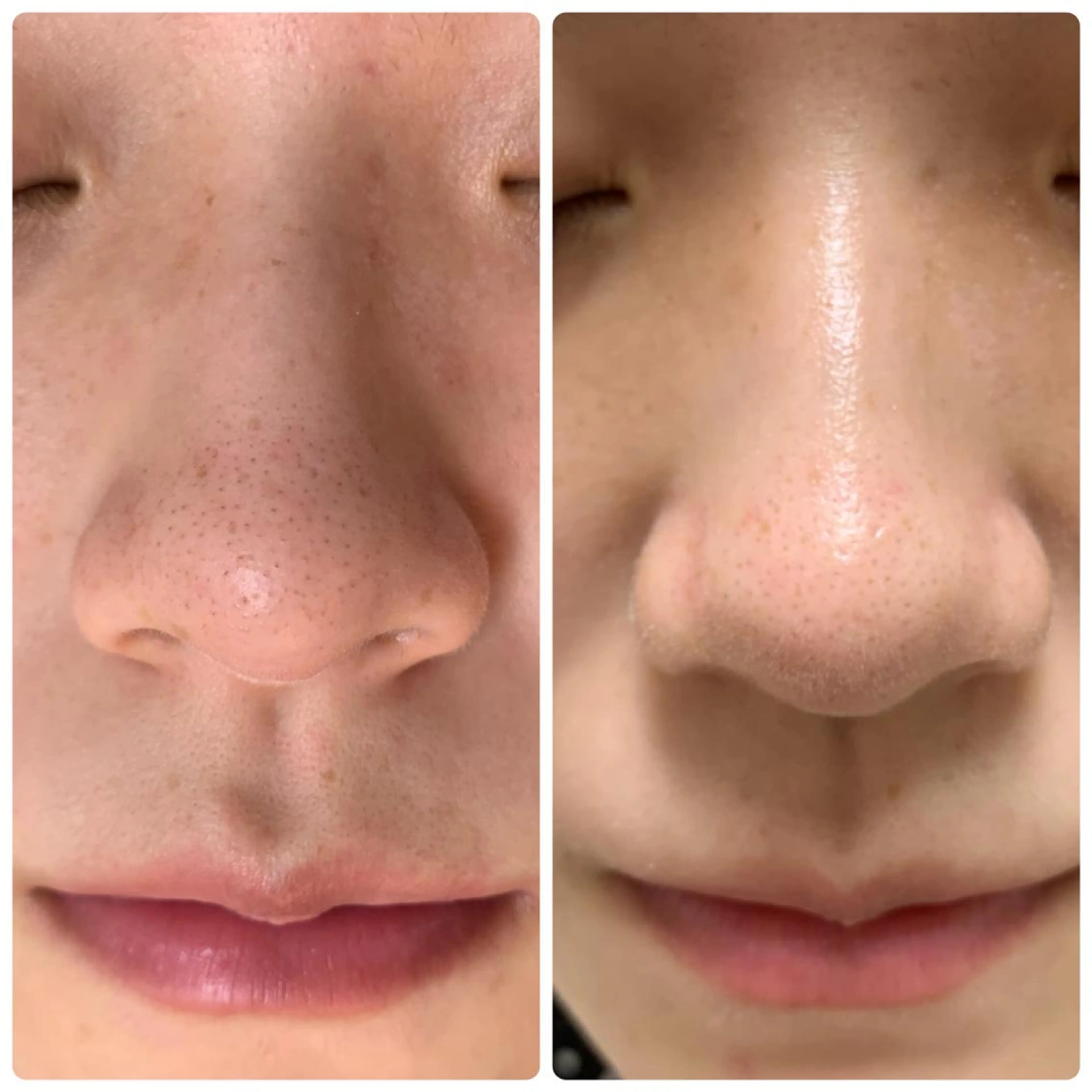 美肌&アロマ🌙 nana 目白/池袋のエステ・リラクイメージ