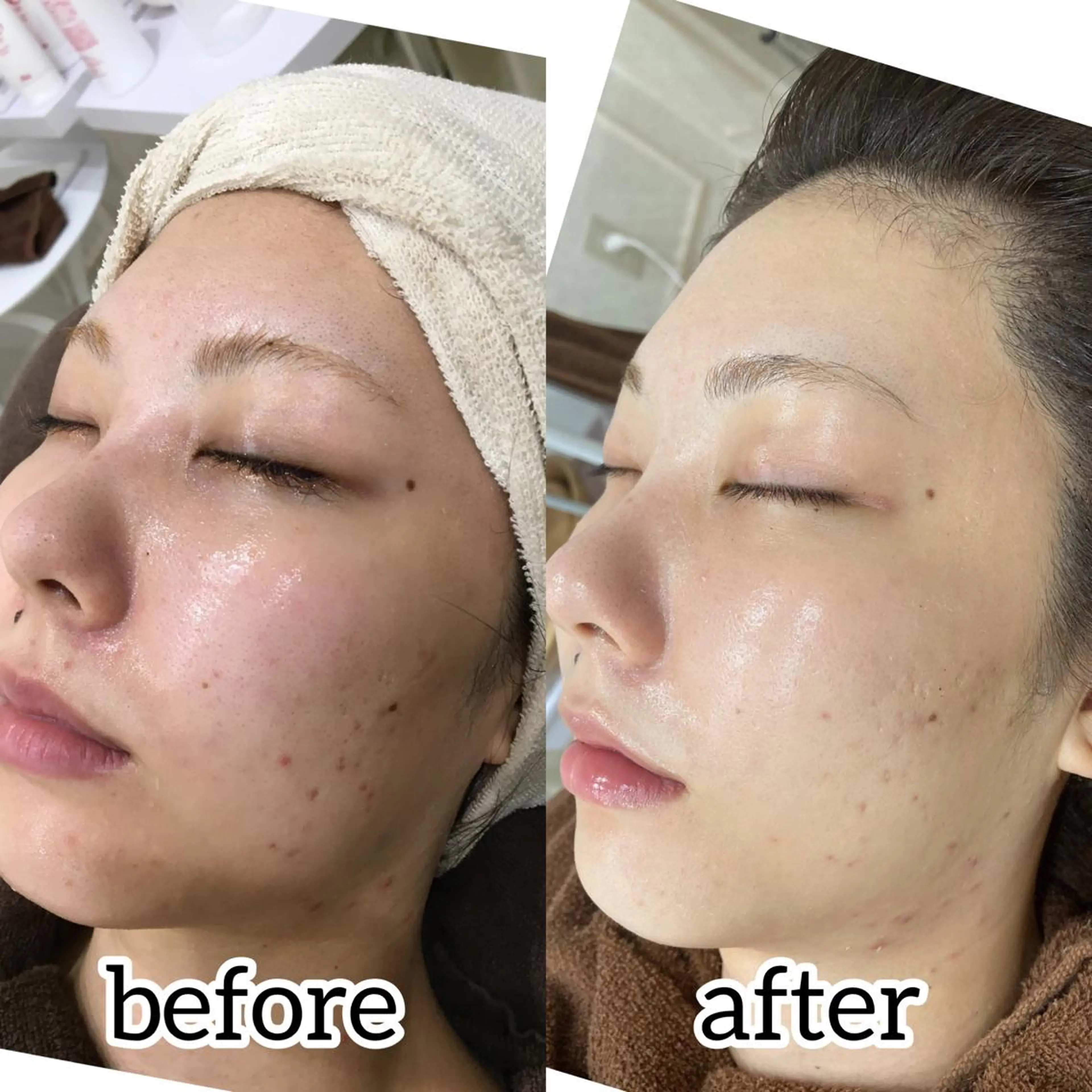 laluna saki...のその他イメージ