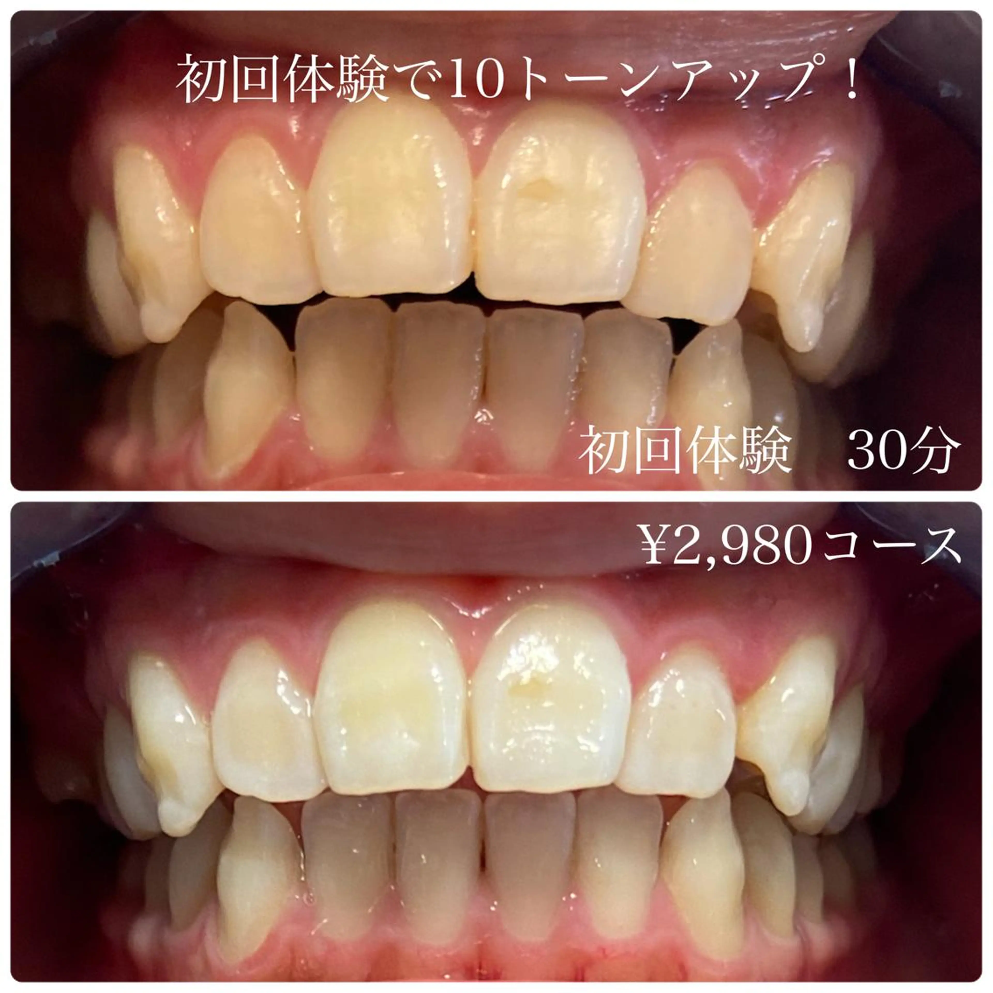 その他 ホワイトニングルーム 川崎店所属・ホワイトニング ルーム 川崎店のその他イメージ