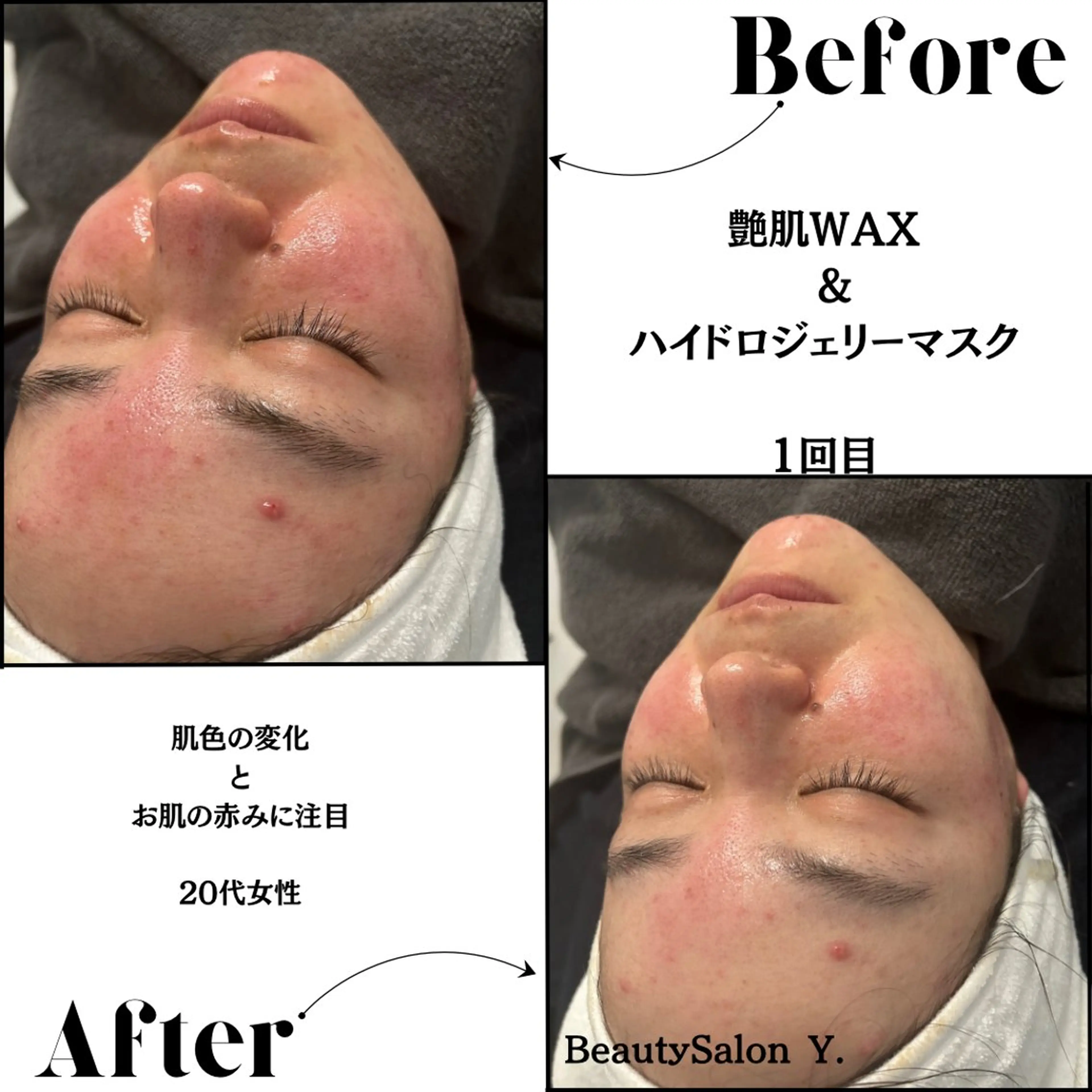 その他 体質／肌質改善専門店 Y.【ワイドット】のエステ・リラクイメージ