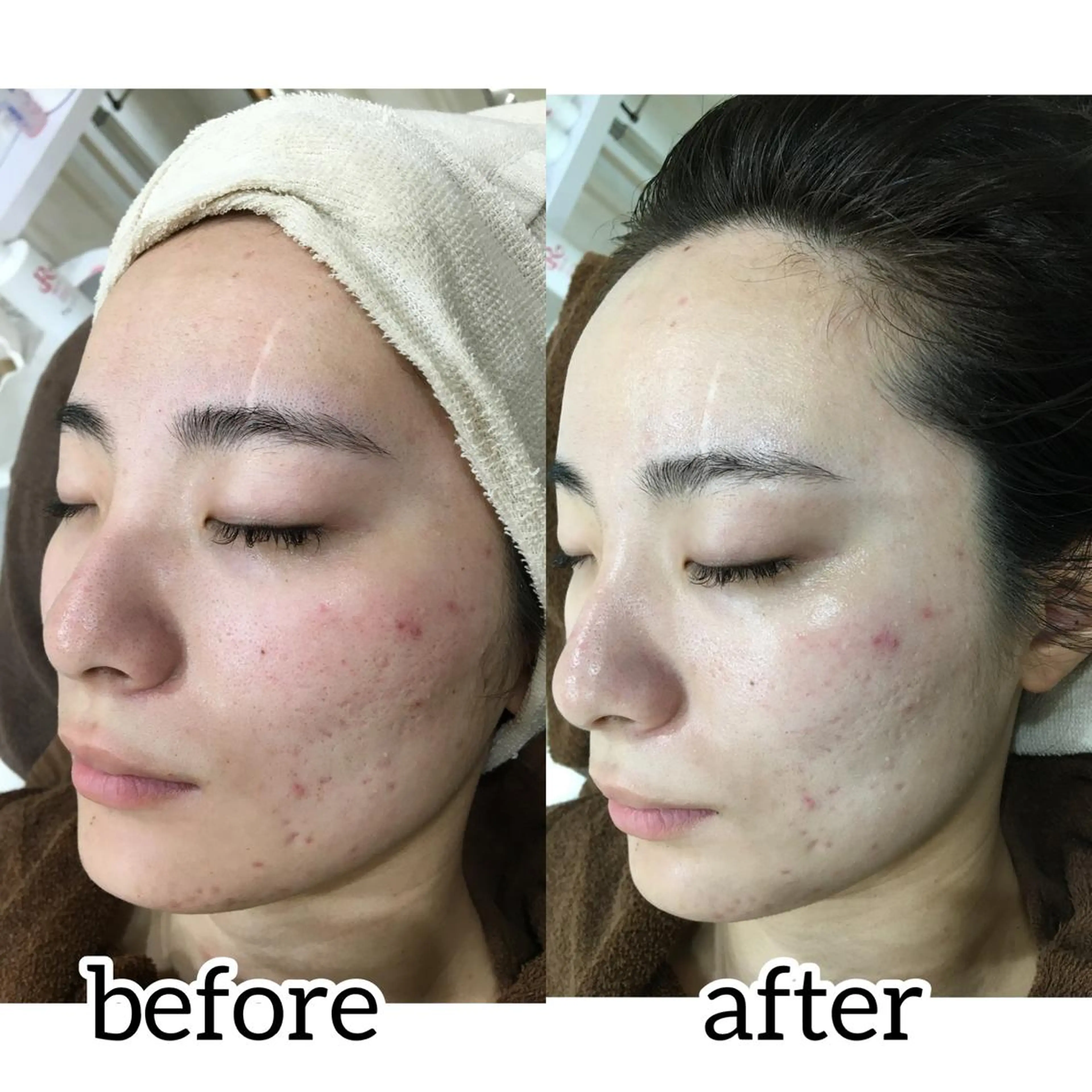 laluna saki...のその他イメージ