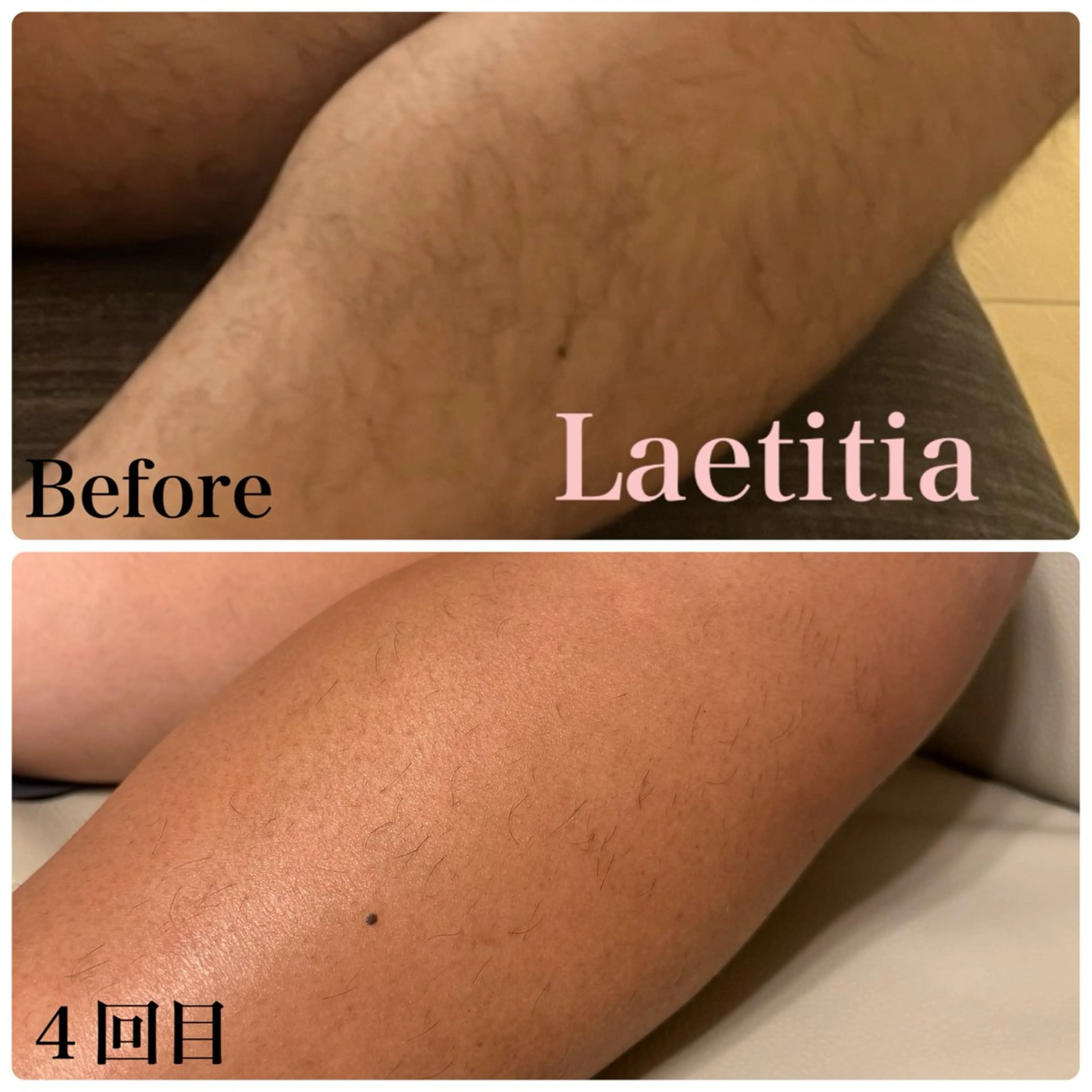 脱毛 レティティア【Laetitia】所属・レティティア秋葉原店 Yoshizawaのエステ・リラクイメージ