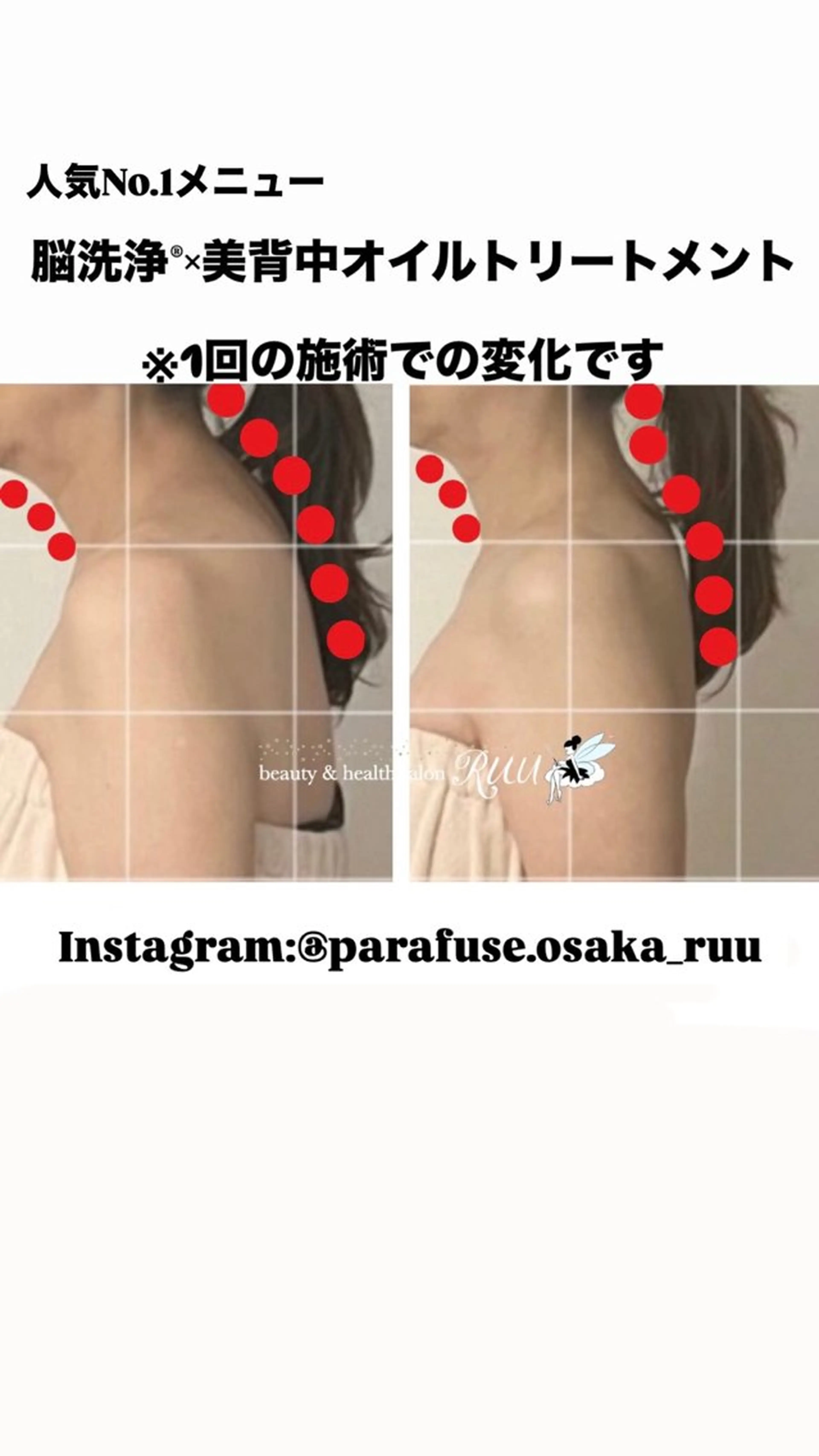 エステ リラク 【頭痛、睡眠改善】 salon RUUのエステ・リラクイメージ