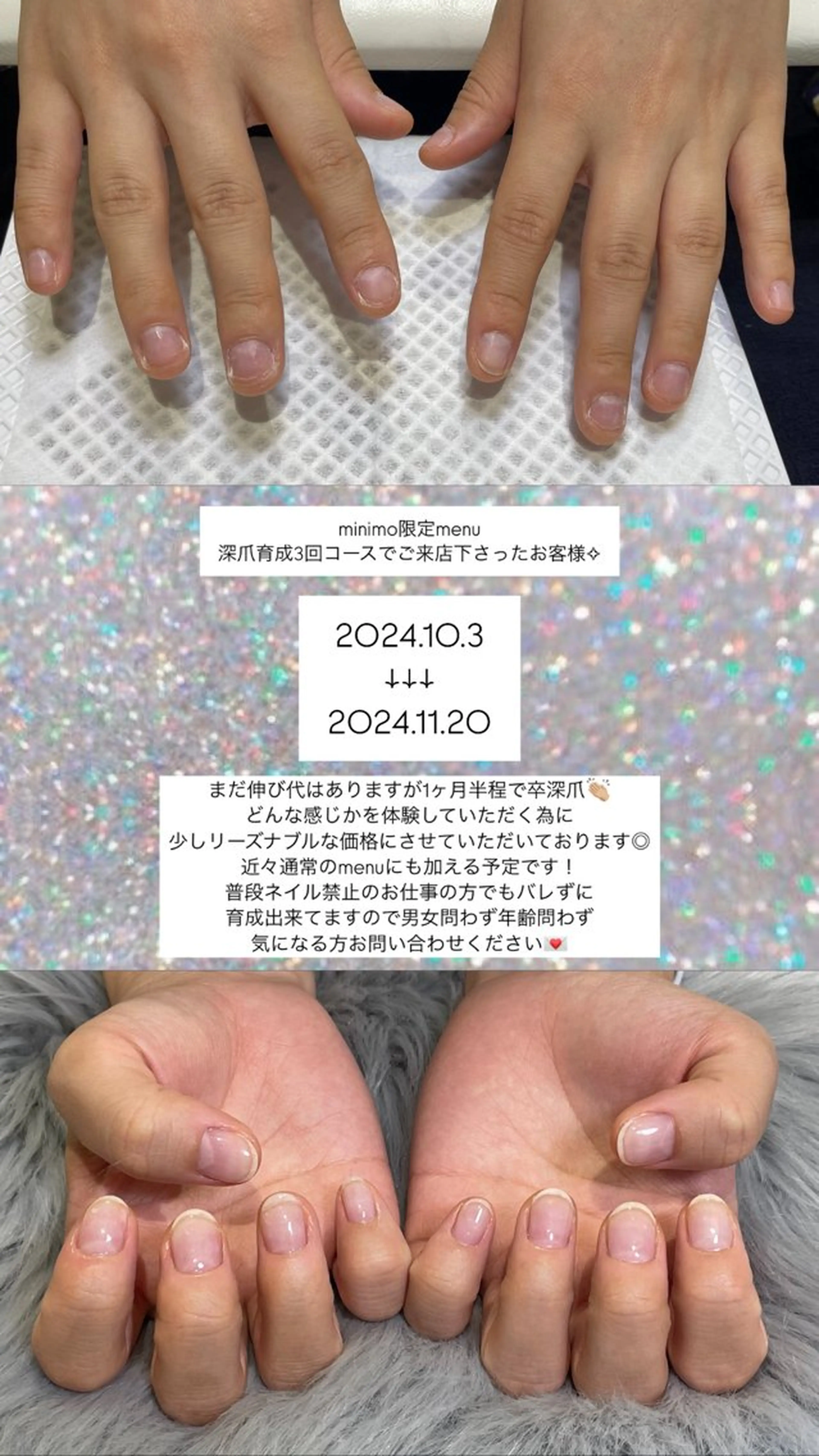 深爪育成💡ジェルワンカラー付き【3回分】🤝🏼✨深爪でお悩みの方是非✨の写真