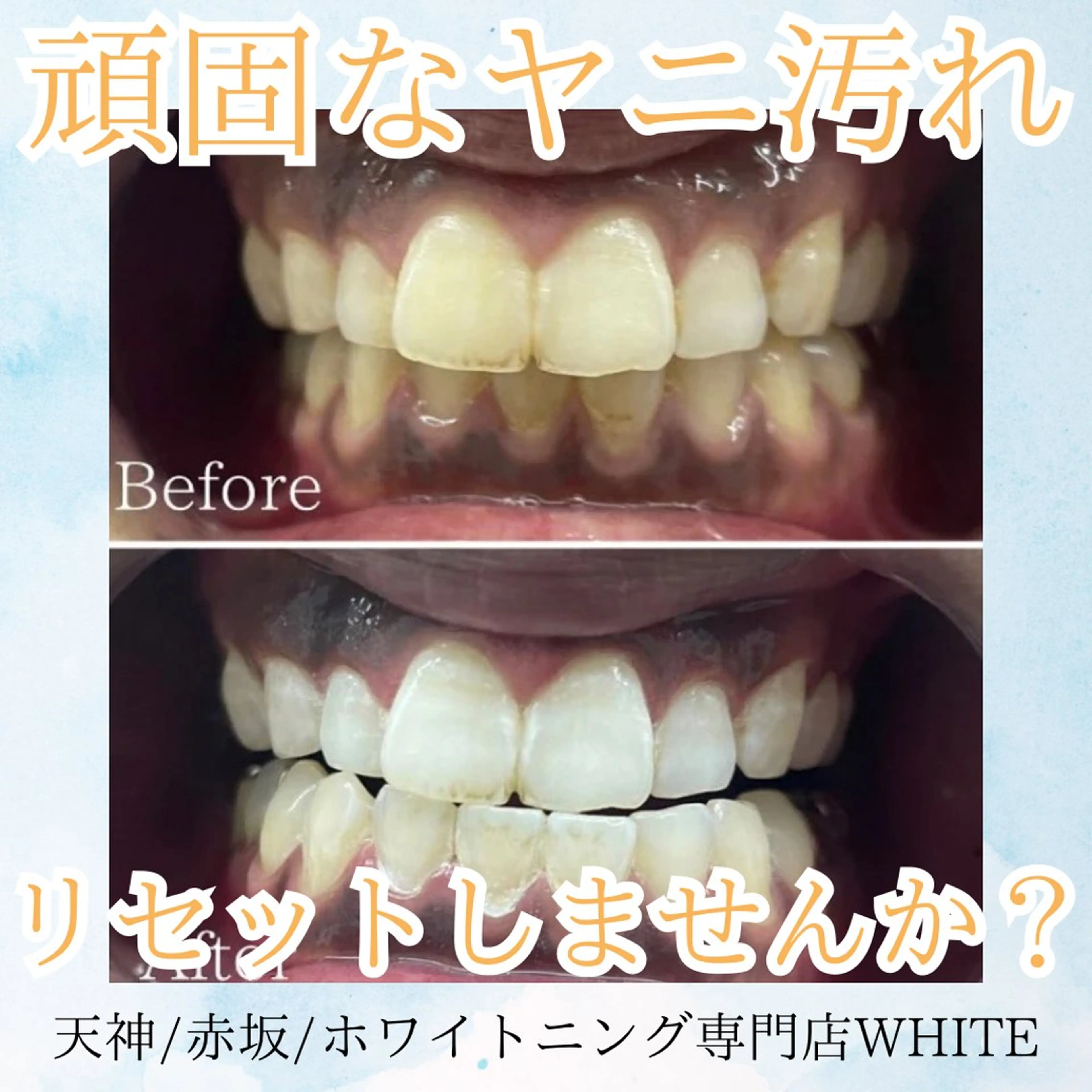 メンズ その他 ホワイトニング専門店 WHITE天神店のエステ・リラクイメージ