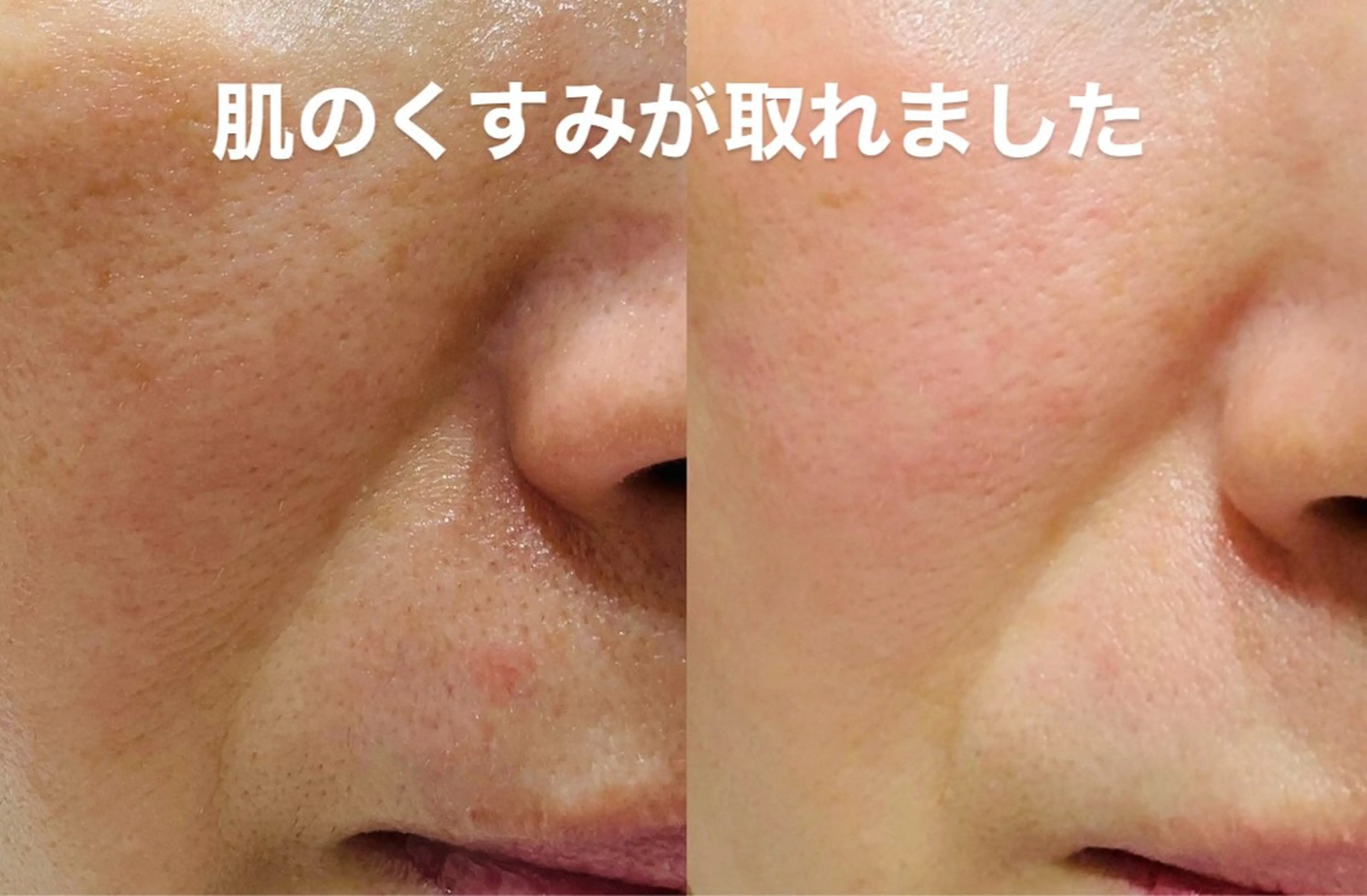 mire（ミレ） トータルビューティーのエステ・リラクイメージ