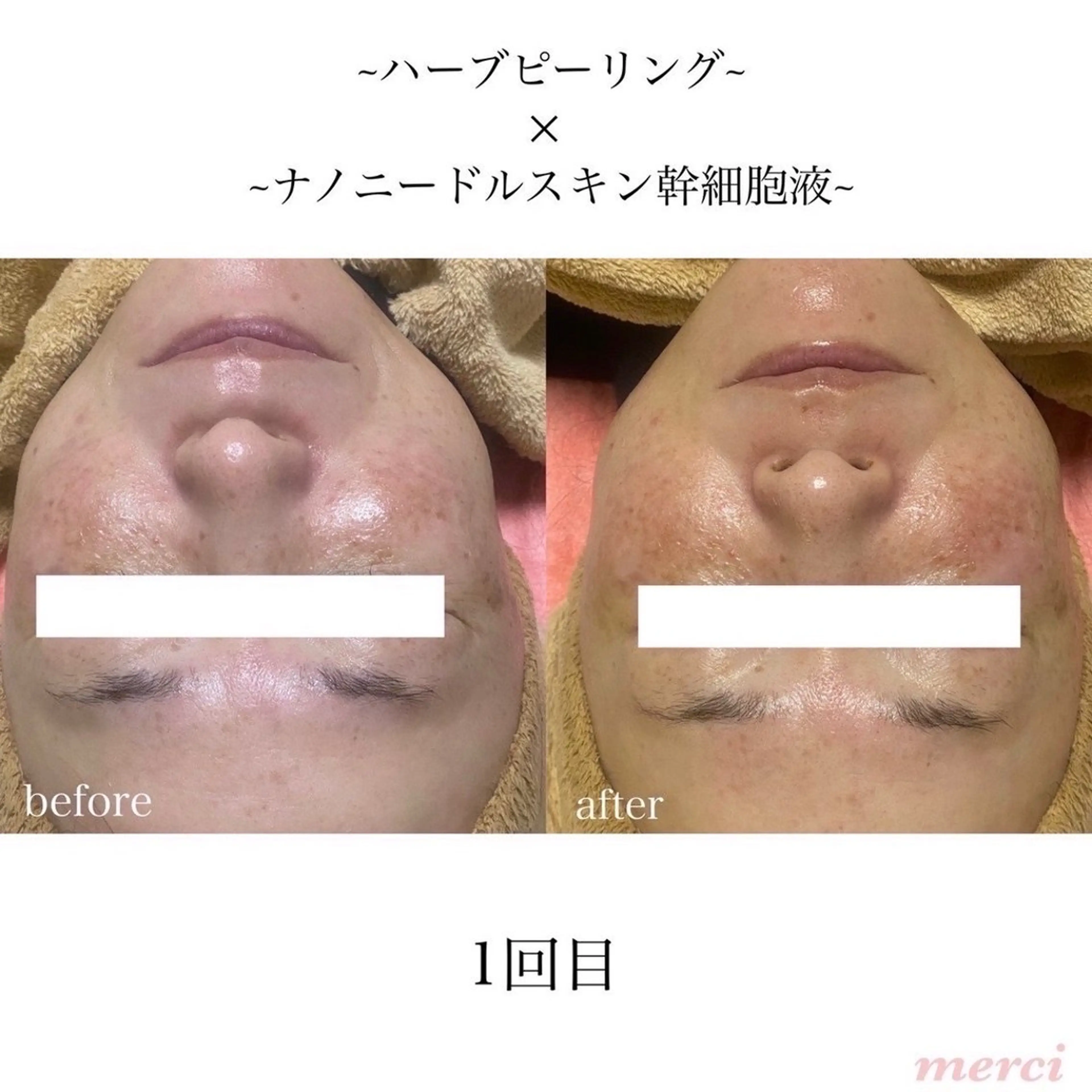 エステ salon merciのエステ・リラクイメージ