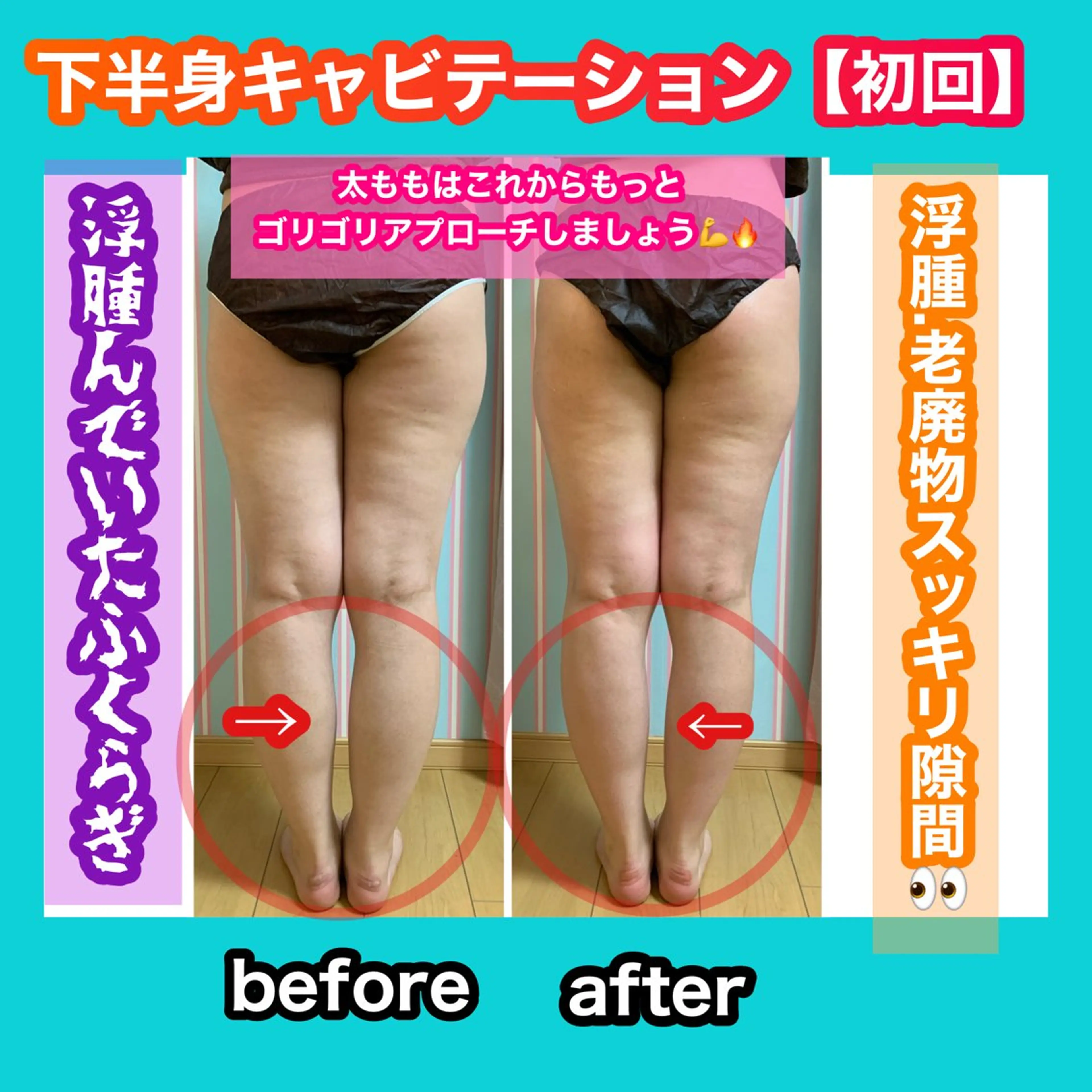 エステ リラク 痩身/脱毛/ネイル HARUKAのエステ・リラクイメージ