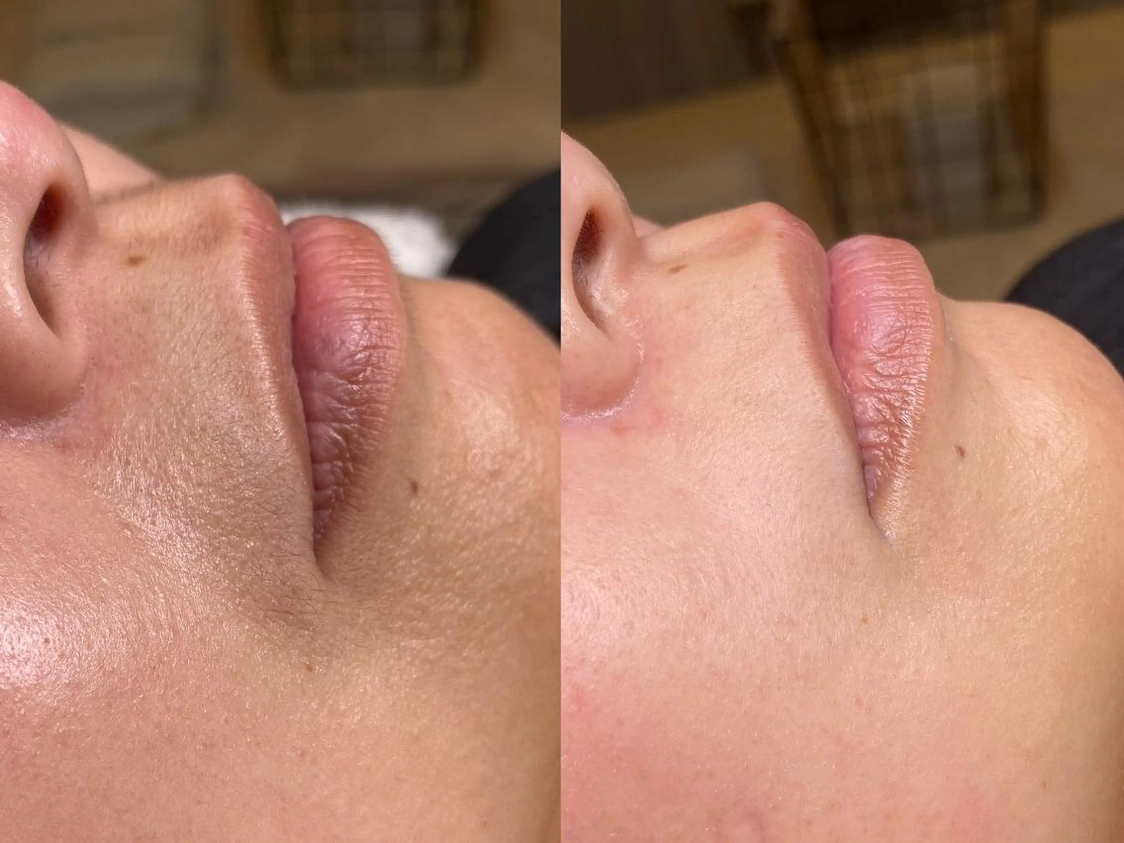 脱毛 大原 伊吹のその他イメージ