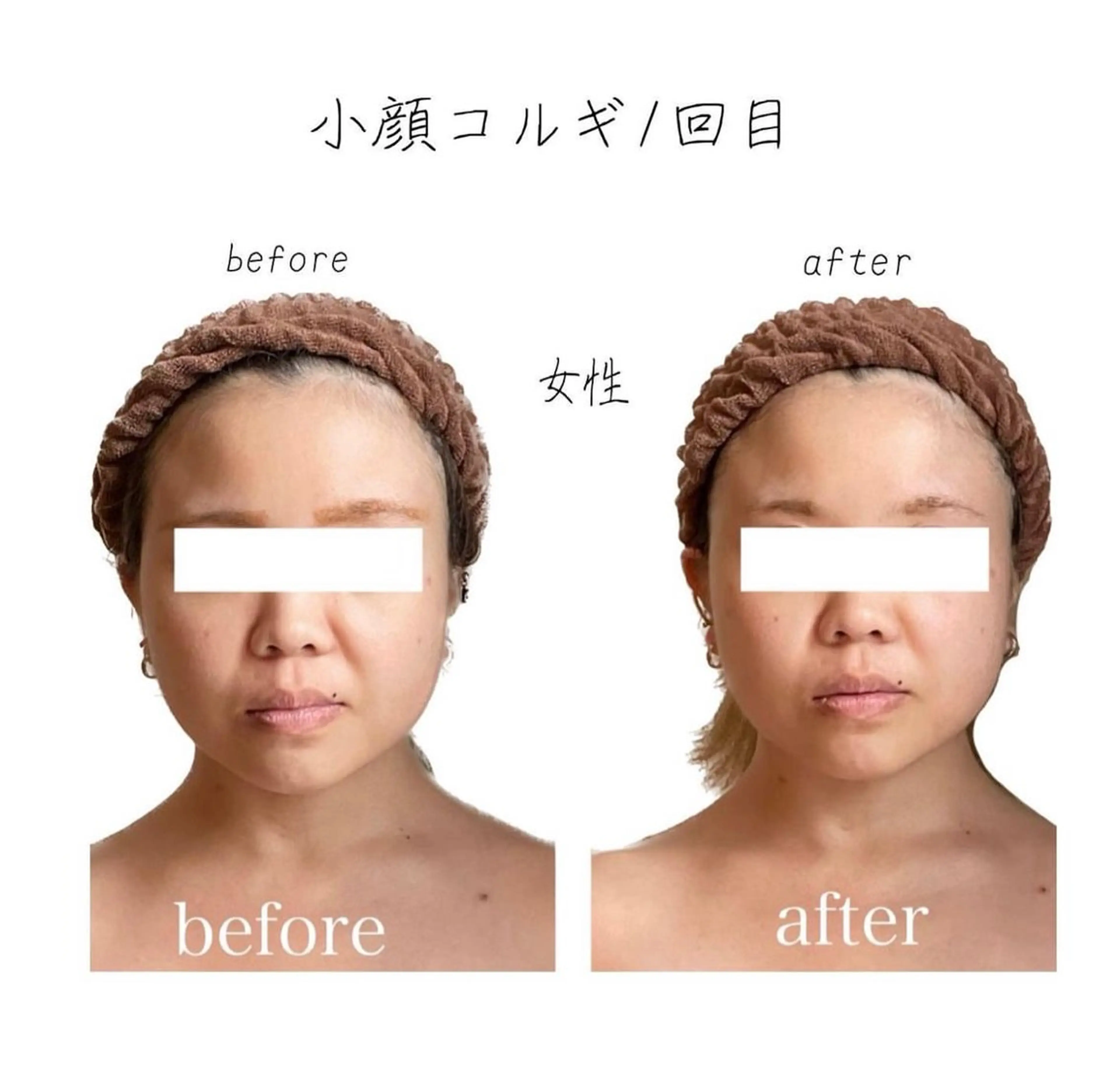 小顔コルギ専門店/隠れ家サロン《여름ヨルム》所属・小顔コルギ専門店 《ヨルム》龍ケ崎店のエステ・リラクイメージ