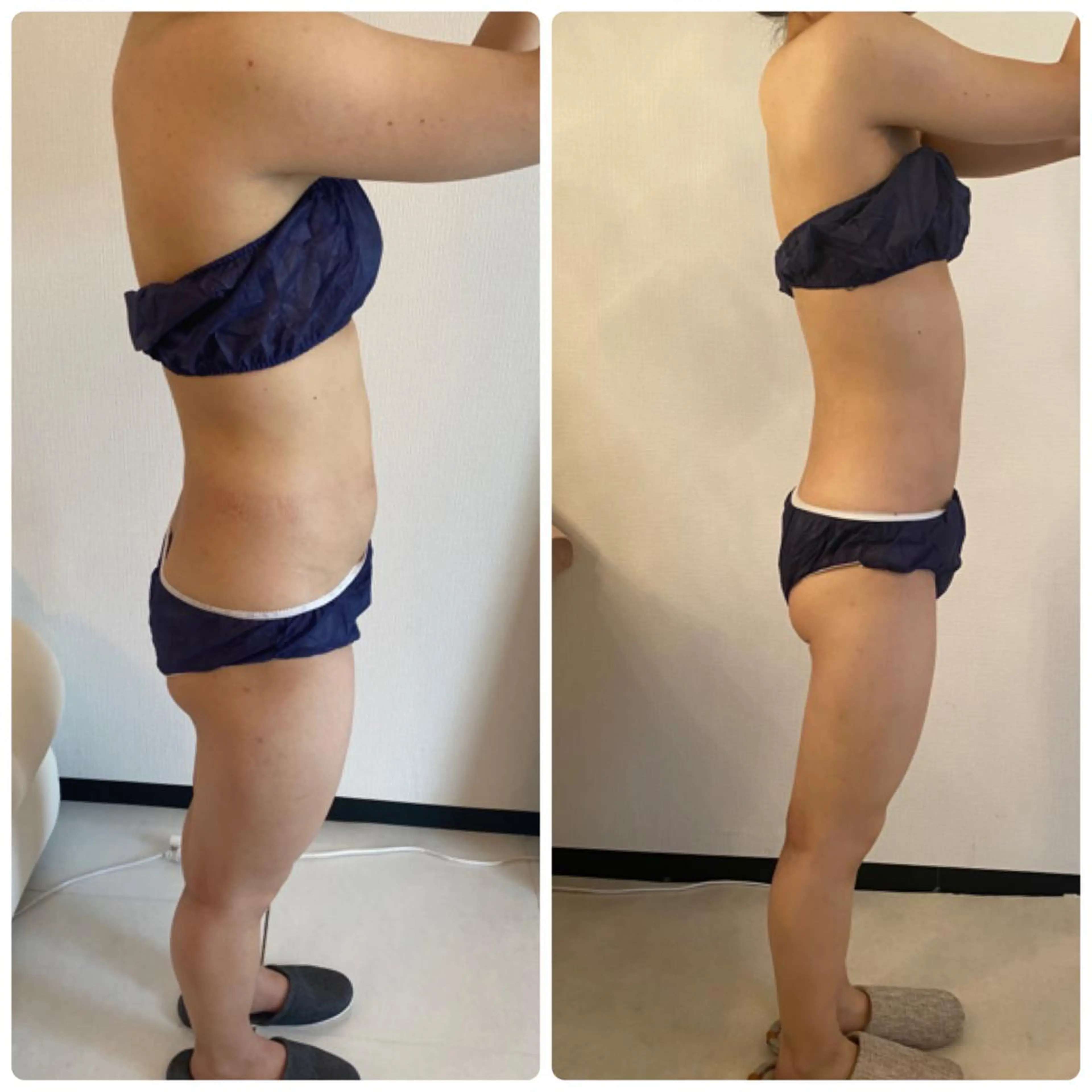 FLEUR大阪・整体 ・ハイフ・痩身・小顔のエステ・リラクイメージ