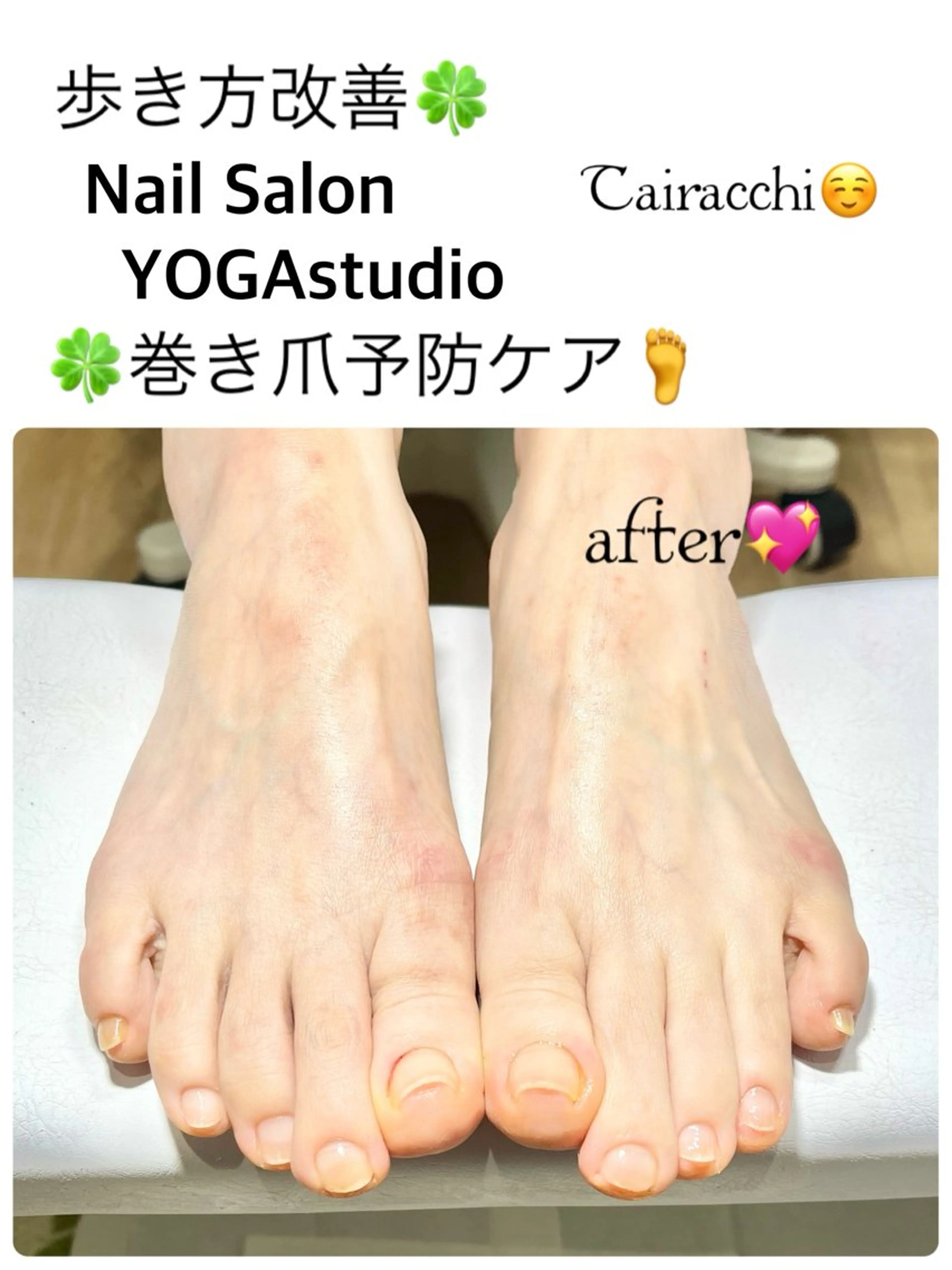 ネイル フットネイル フットネイル Tairacchi ﾀｲﾗｯﾁのエステ・リラクイメージ