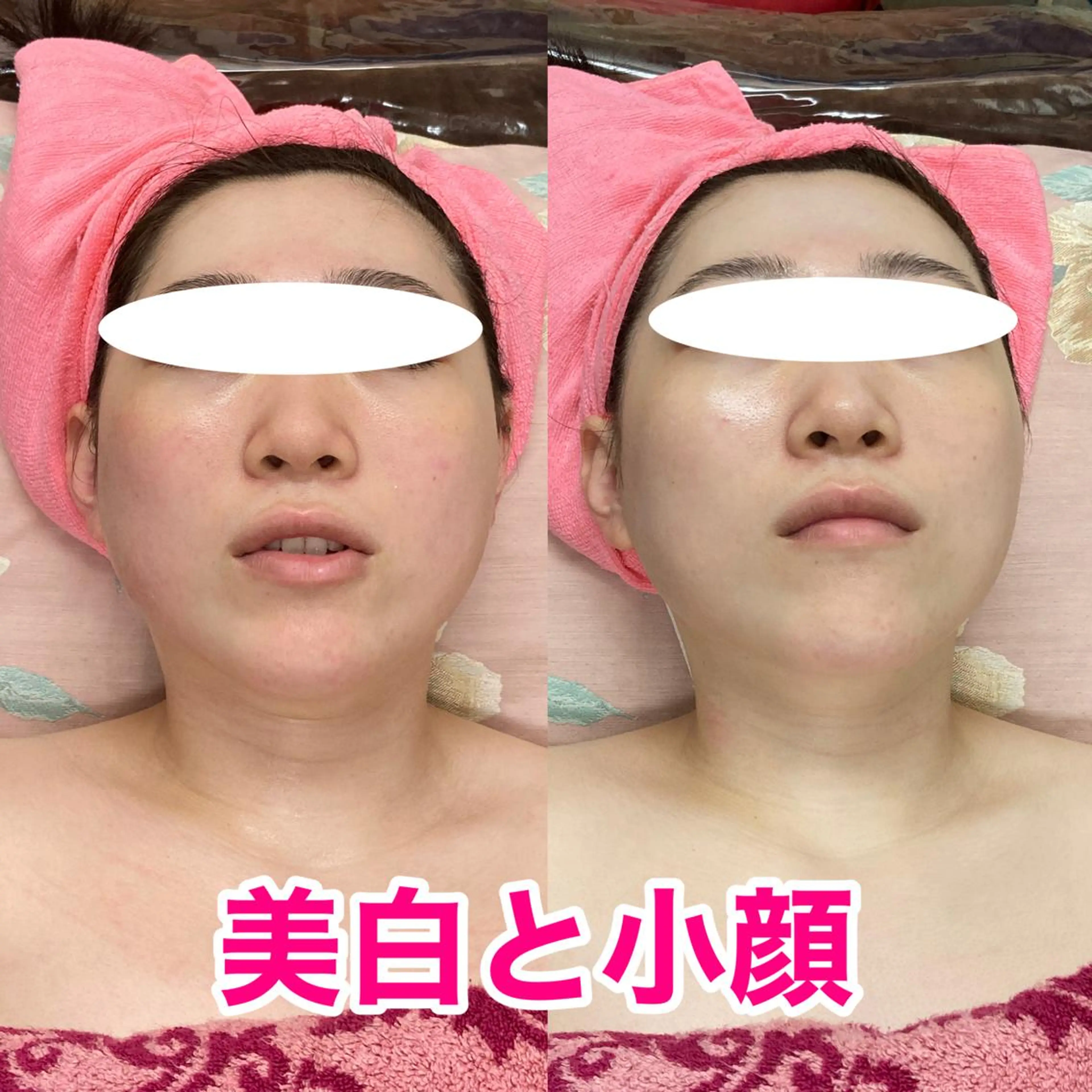 オアシス・さくら所属・中村貴子都度払い脱毛 小顔コルギのエステ・リラクイメージ