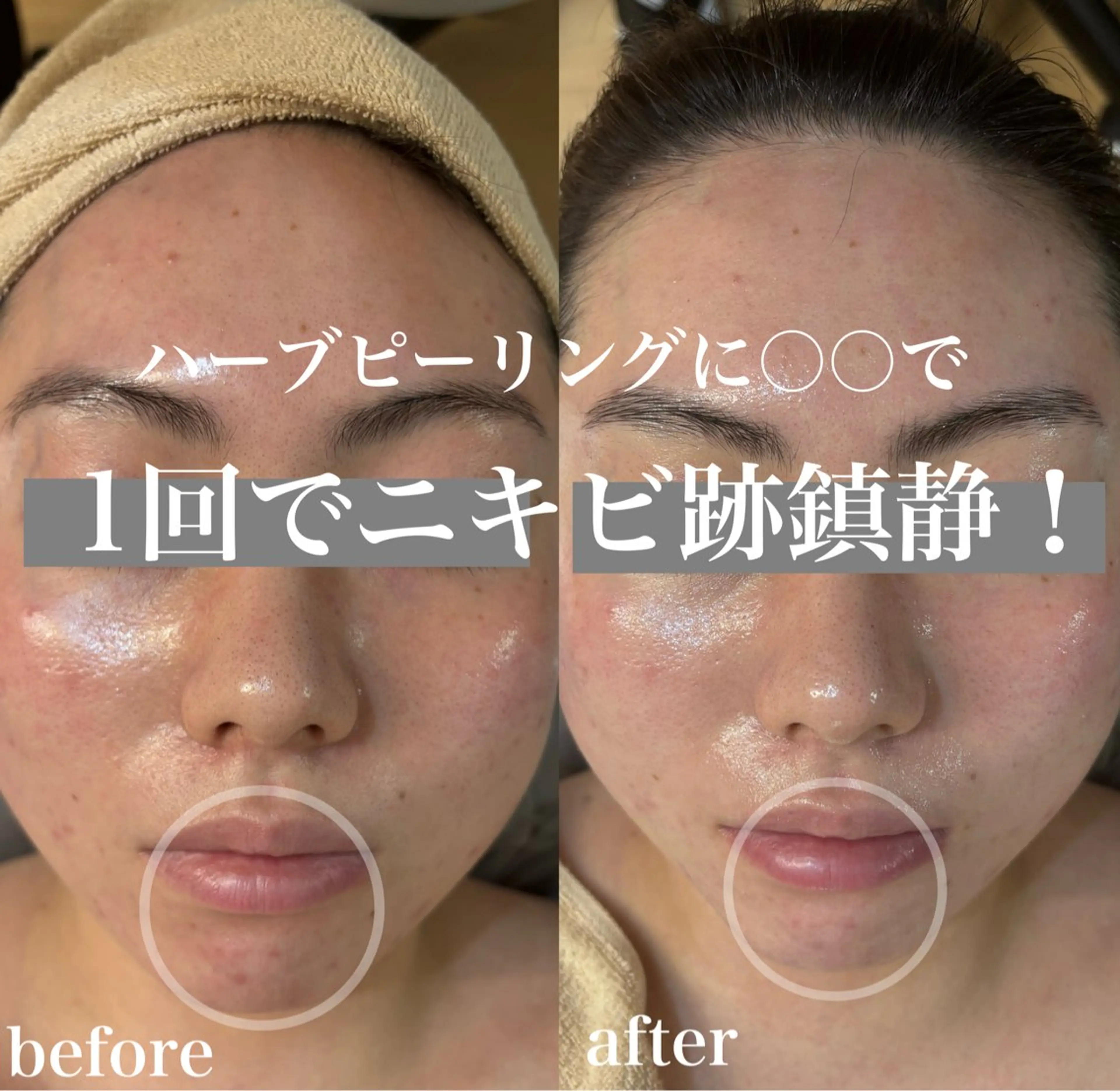 エステ WHITE AQUA 北千住店のエステ・リラクイメージ