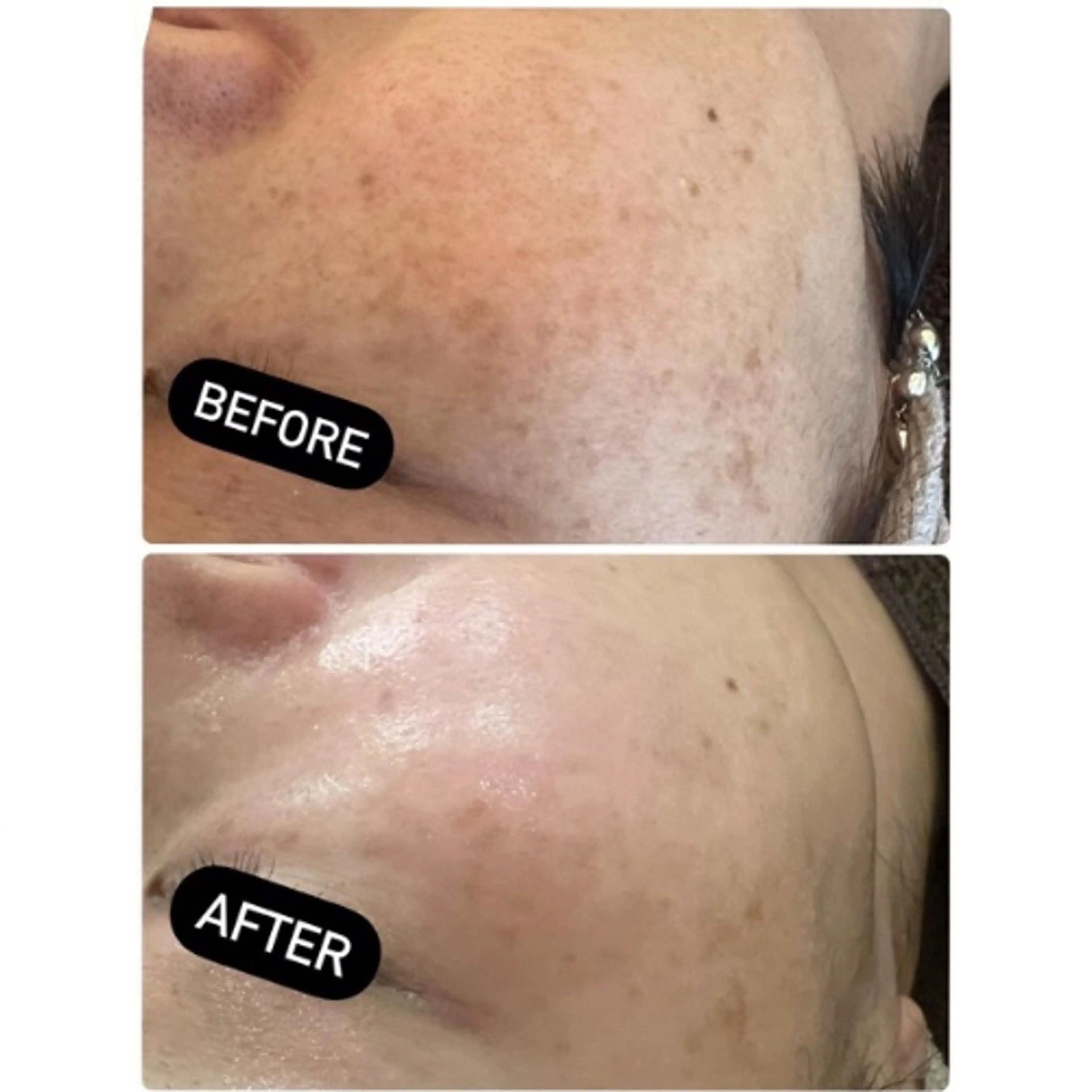 その他 肌質改善｜エステ Connect ゆいのエステ・リラクイメージ