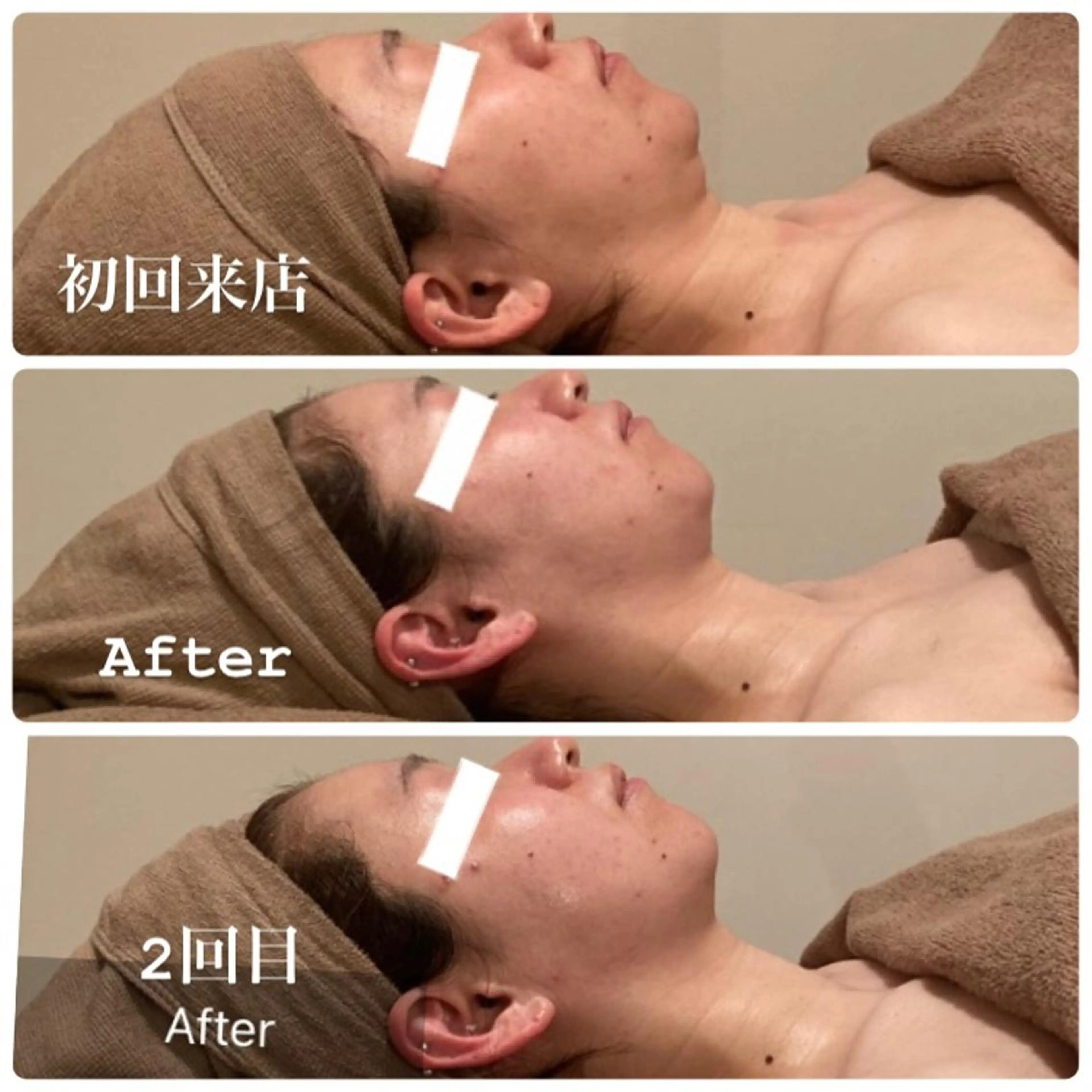 Ｂ&H所属・頭痛•肩こり専門/ 眉サロンB&H心斎橋のエステ・リラクイメージ