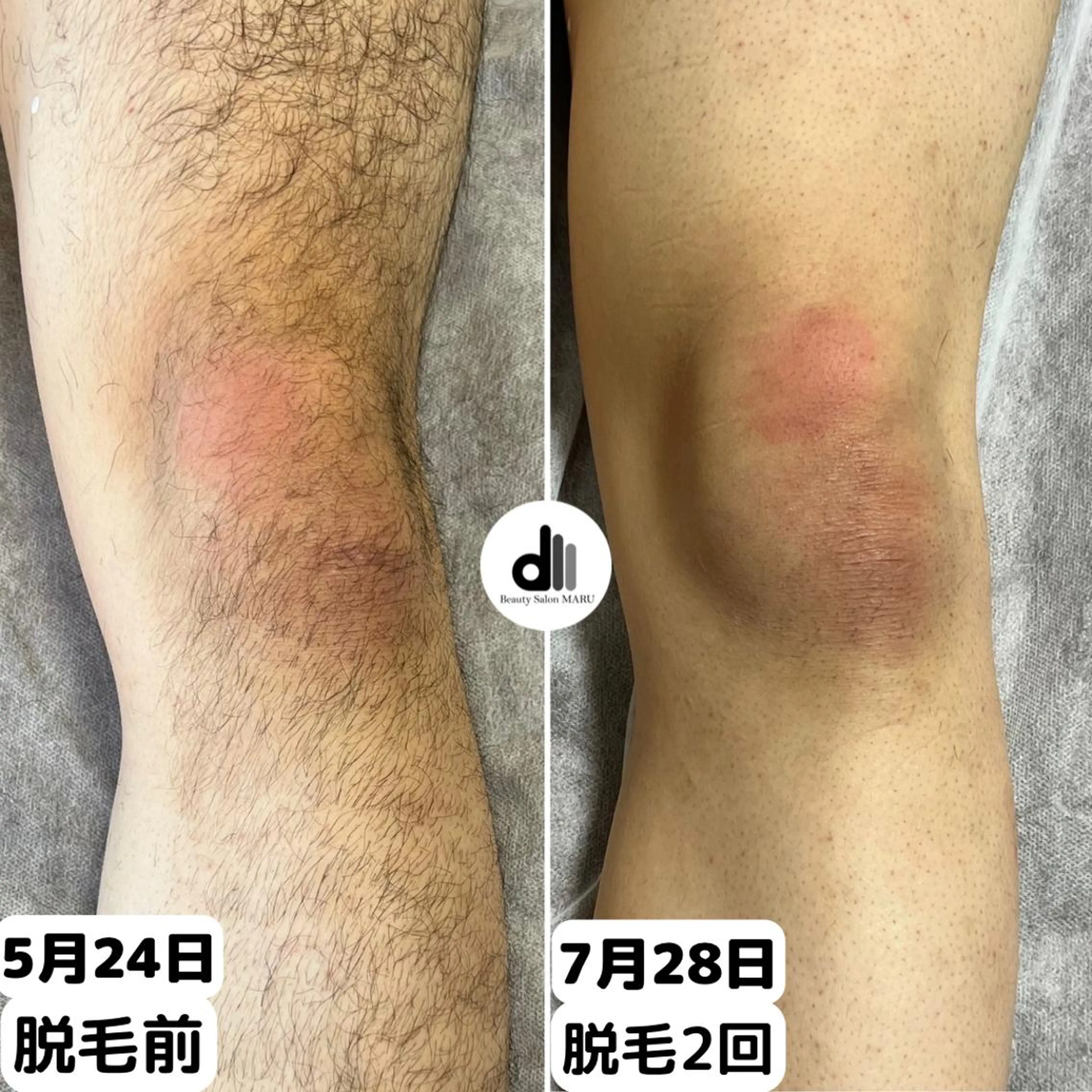 メンズ Beauty Salon MARU所属・新潟市メンズ【脱毛】 MARUのエステ・リラクイメージ