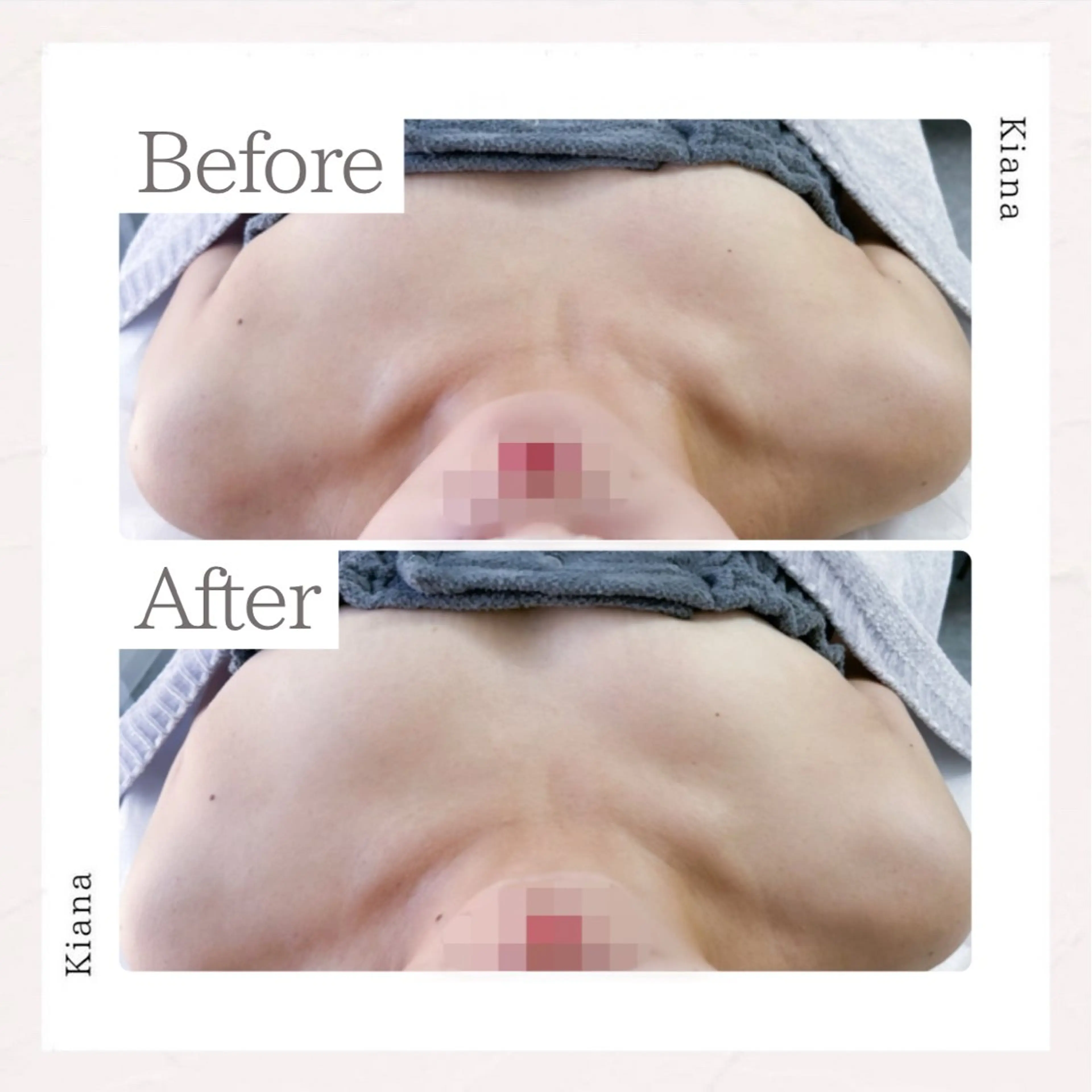 エステ リラク バスト専門Kiana 風のエステ・リラクイメージ