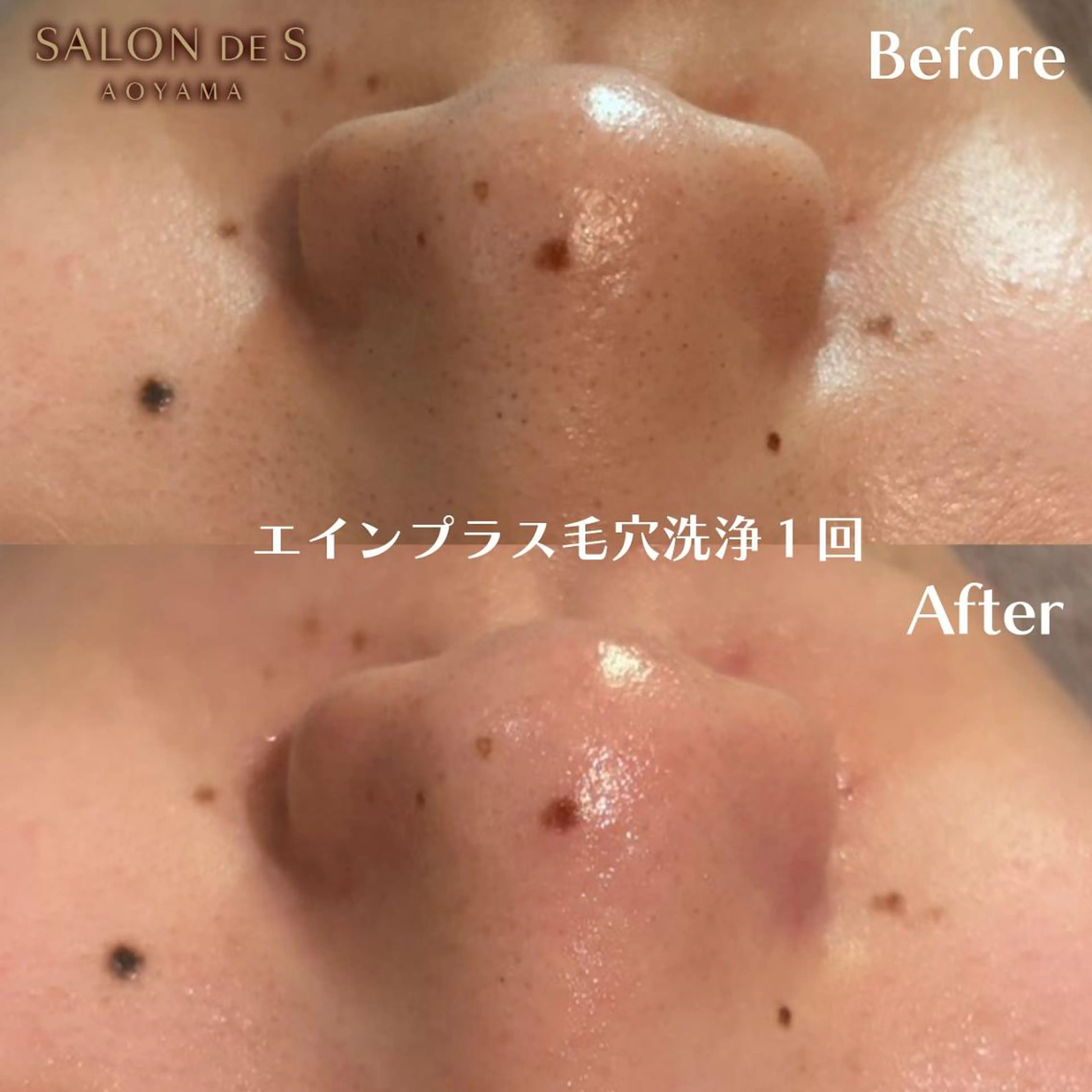 エステ SALON DE S 外苑前♡さやかのエステ・リラクイメージ