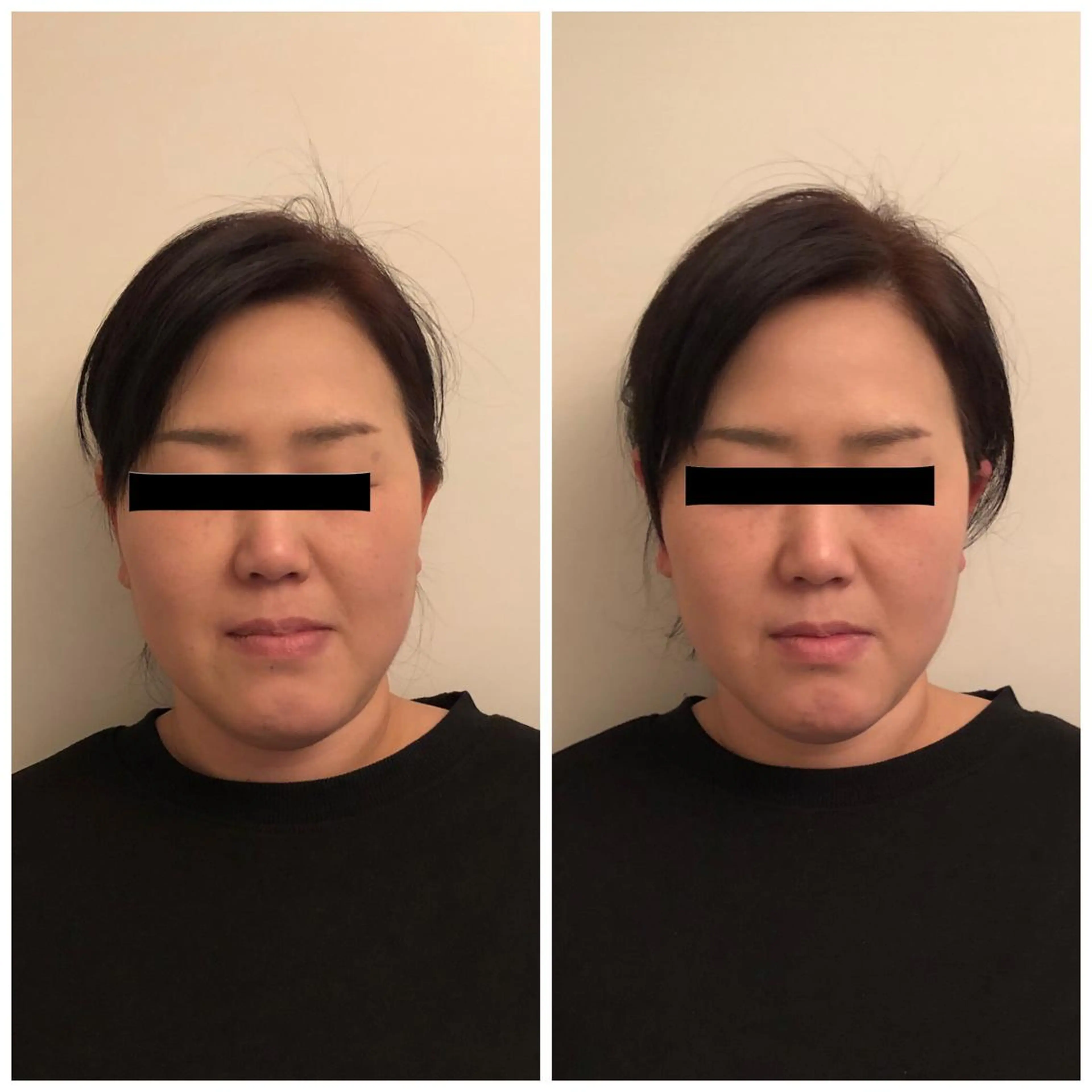 エステ リラク おうちサロン B-ROOMのエステ・リラクイメージ