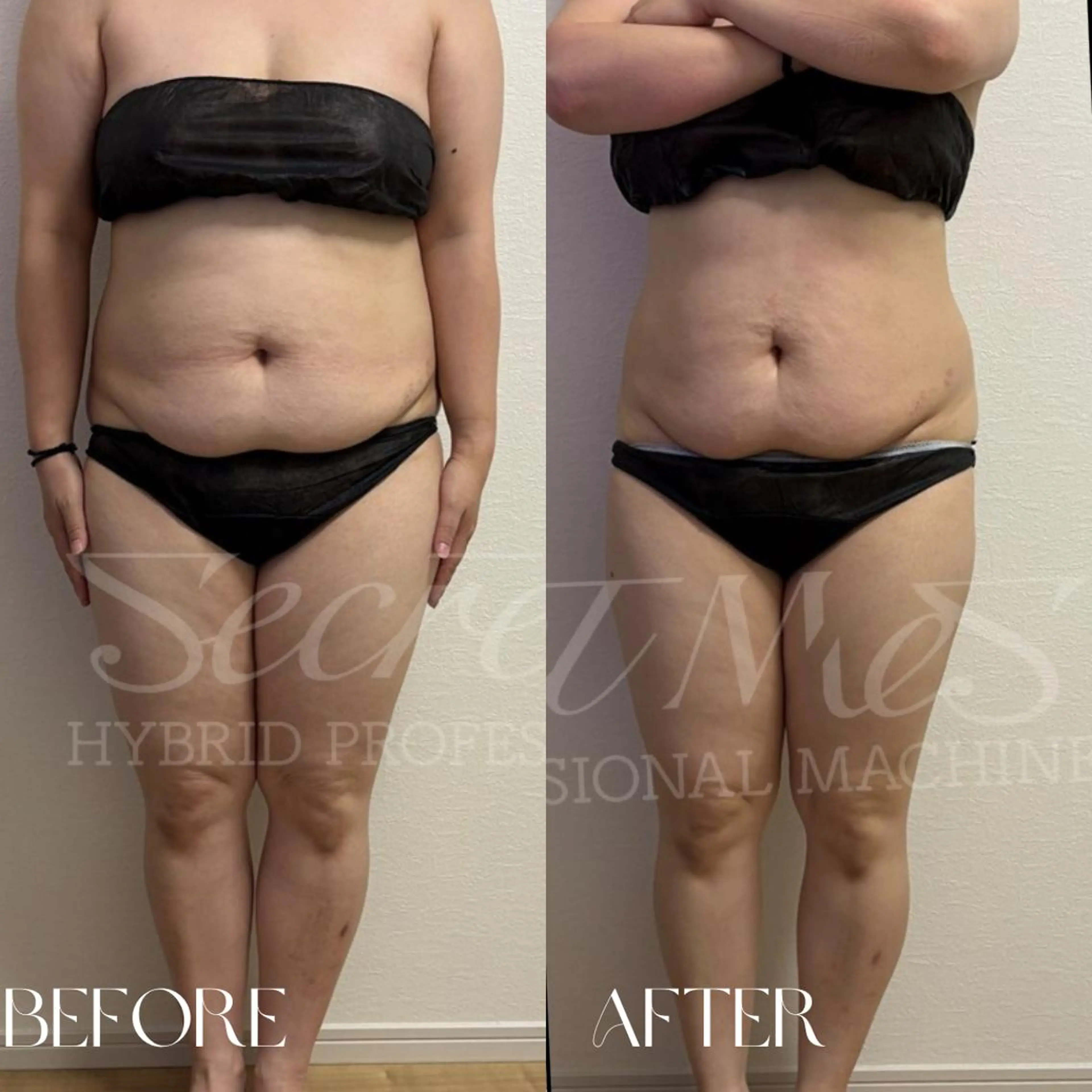 エステ リラク B-st. 下北沢のその他イメージ