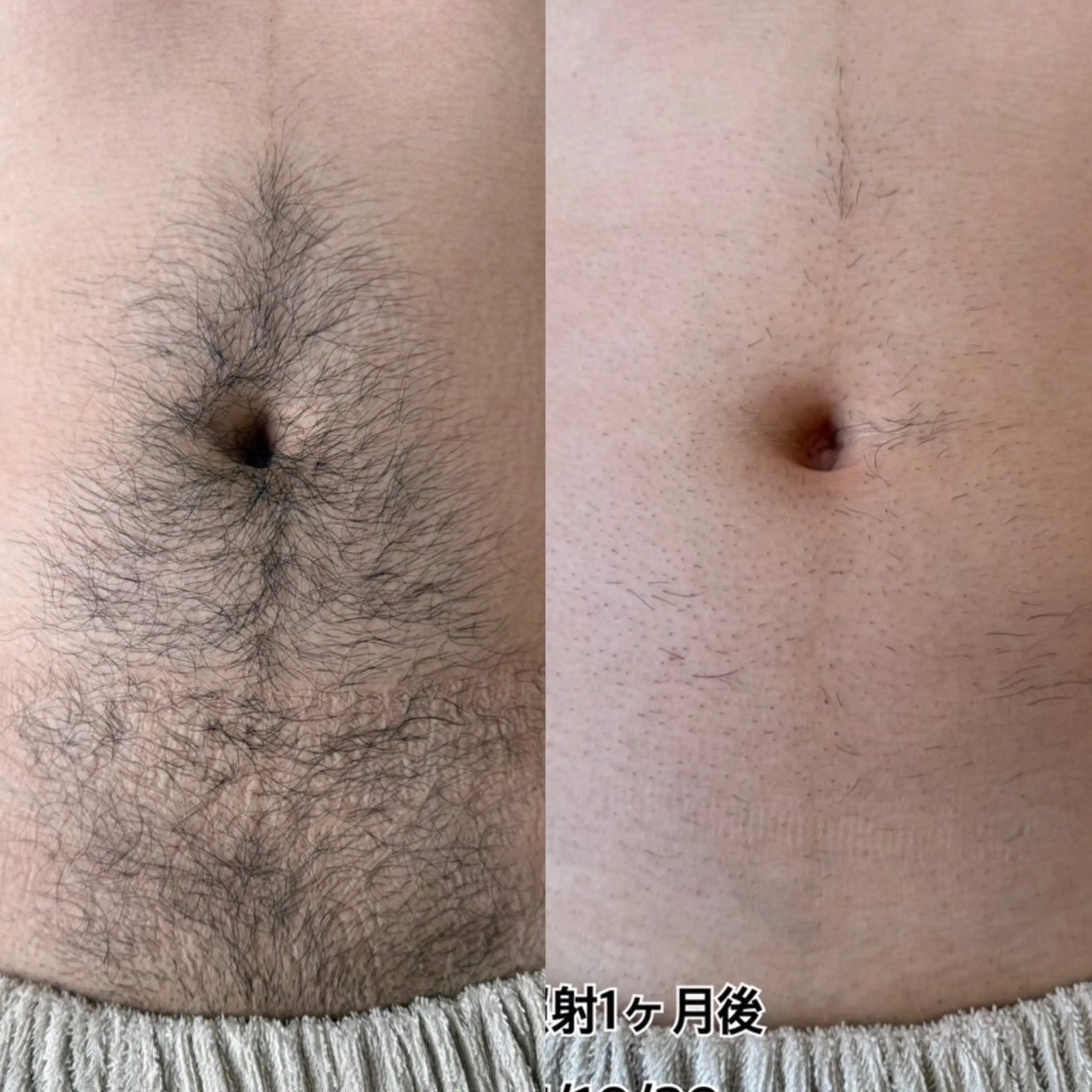 メンズ 脱毛 salon il 【眉毛・脱毛】の眉毛・アイブロウイメージ