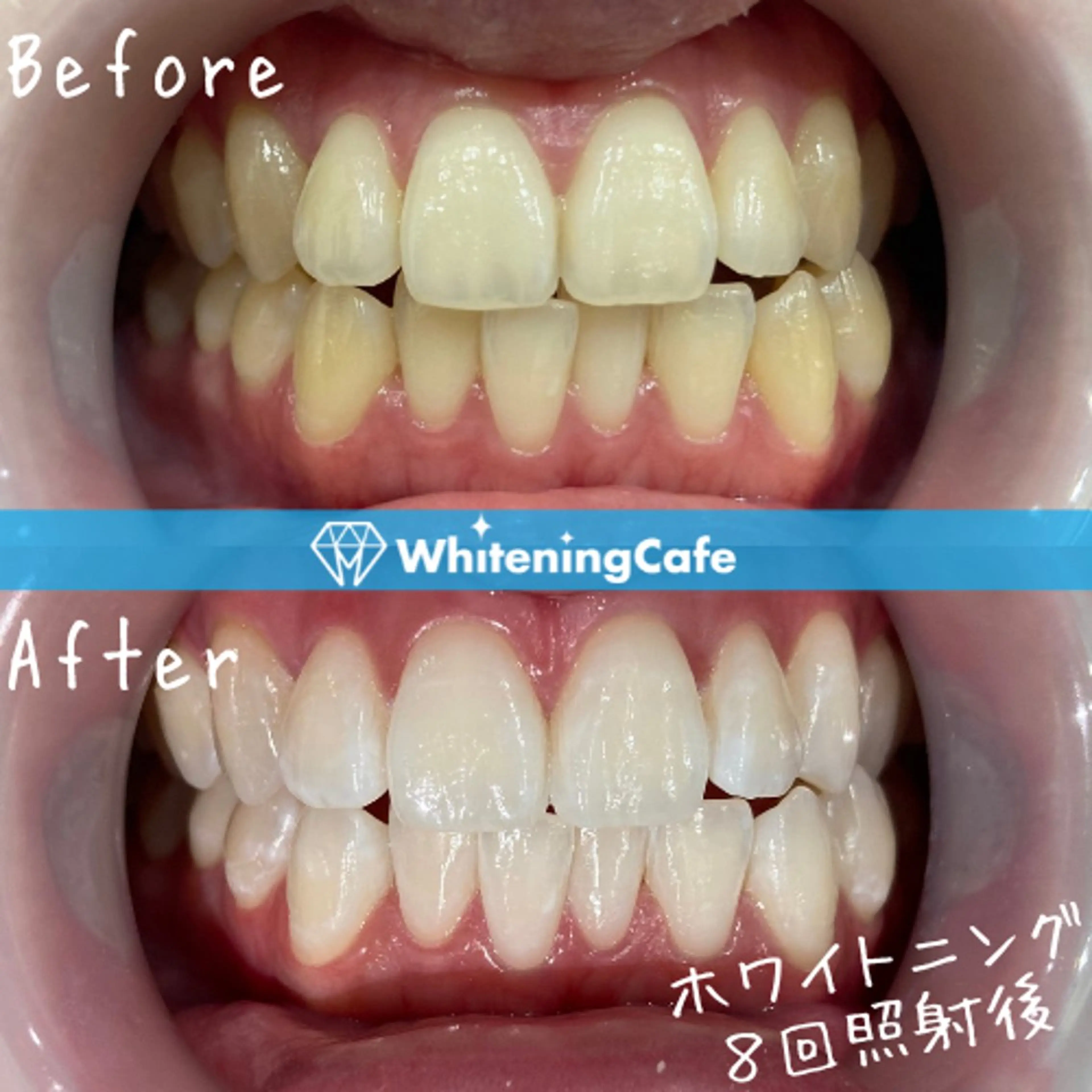 ホワイトニングカフェ神戸元町店所属・ホワイトニングカフェ 神戸元町店のエステ・リラクイメージ