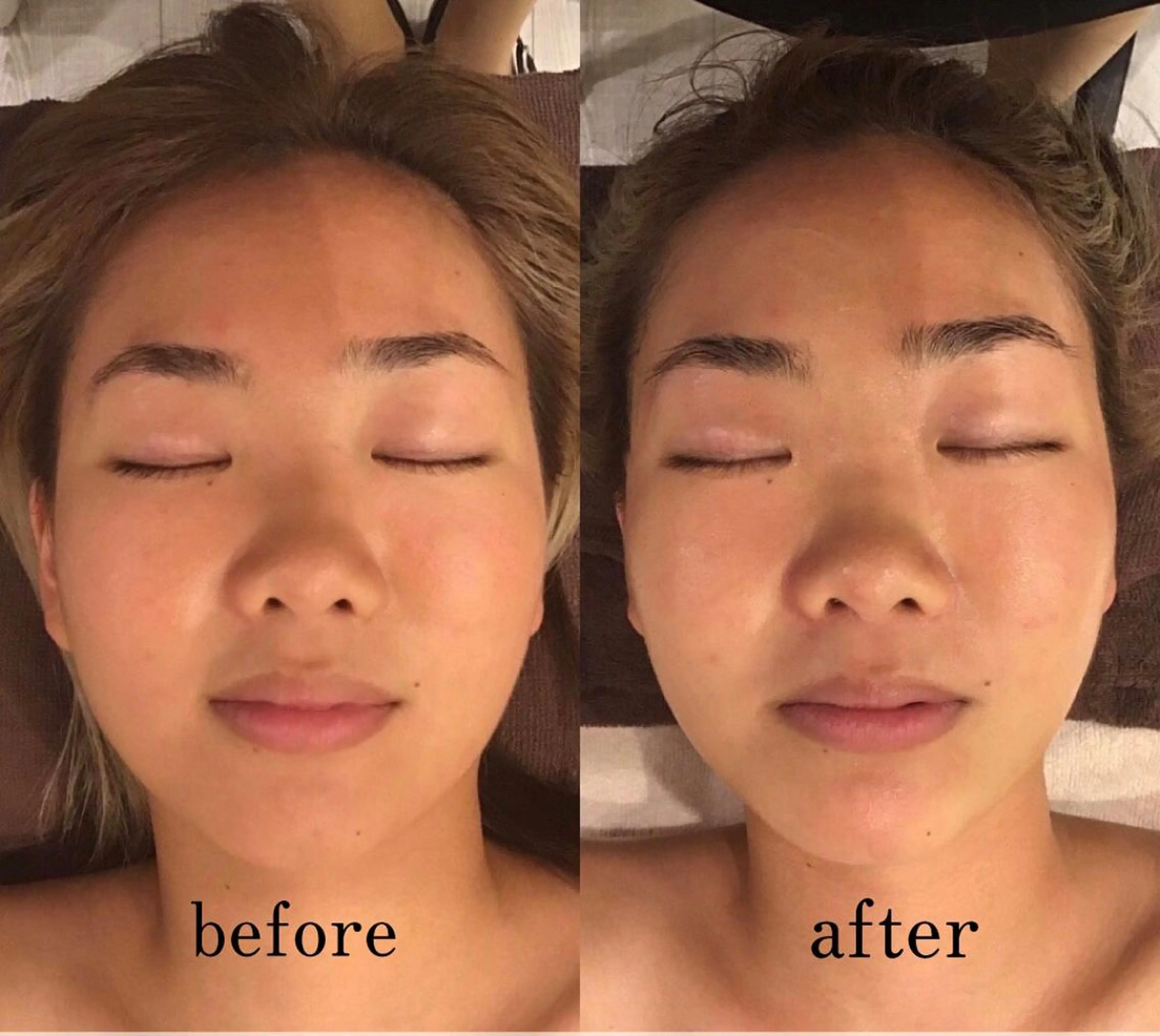 痩身×フェイシャル ブライダル|Linoのエステ・リラクイメージ