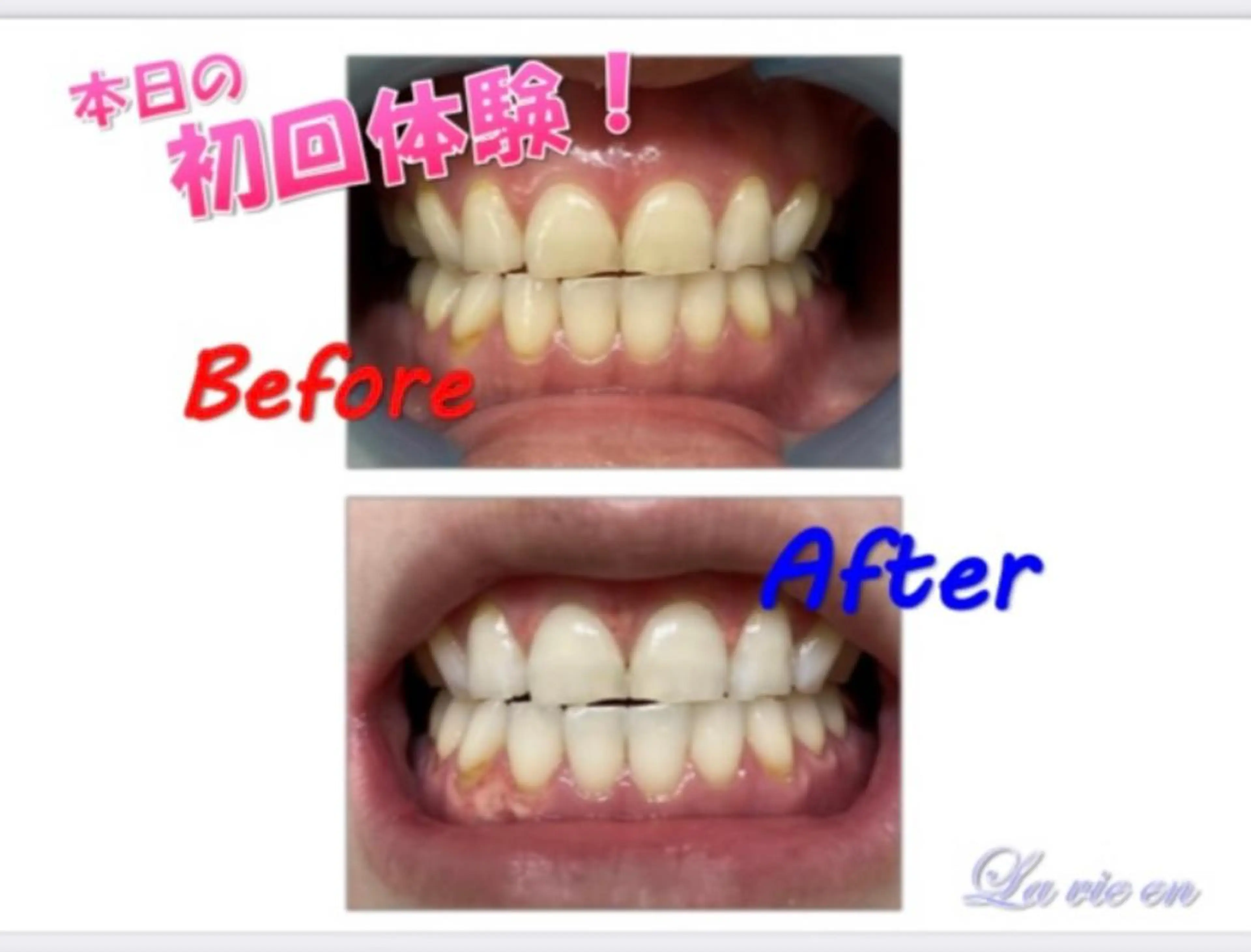 その他 セルフホワイトニングサロン　ラヴィアン所属・ホワイトニングサロン La vie enのその他イメージ