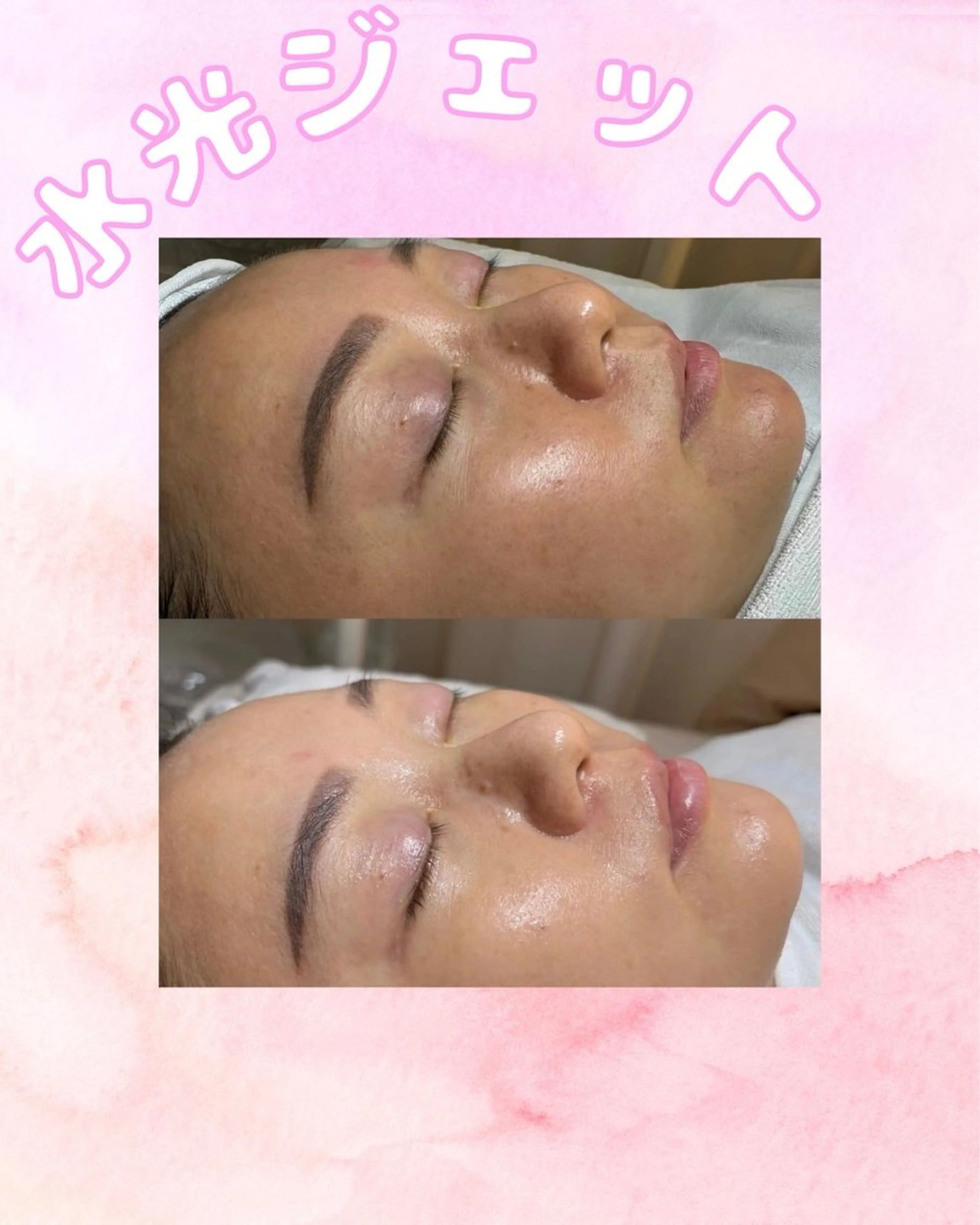 カラー エステ aliaハイフ&水光ジェットサロン所属・aliaハーブ水光店 エステティシャン募集のエステ・リラクイメージ