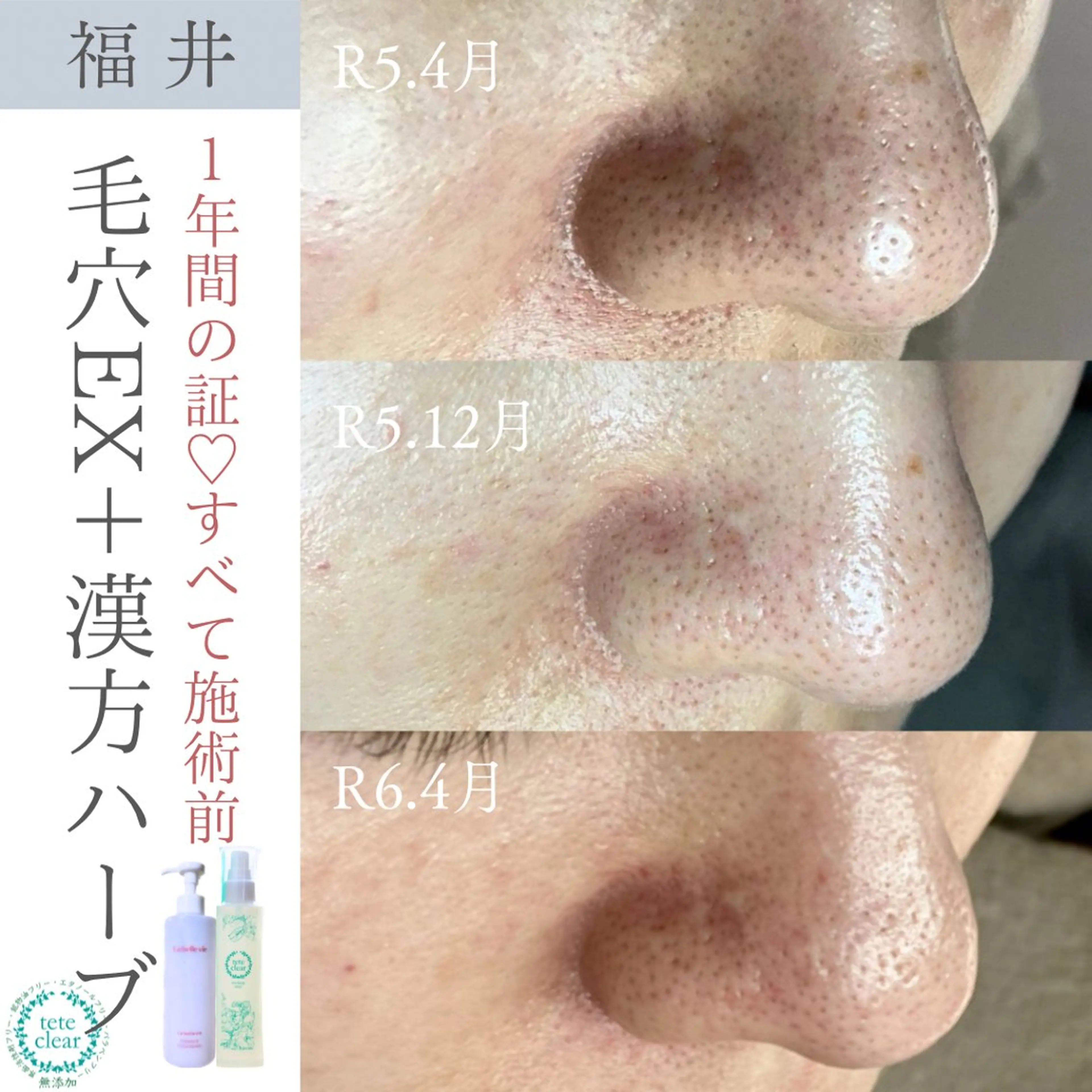 毛穴ケア専門サロン Yourmeユアミーのエステ・リラクイメージ
