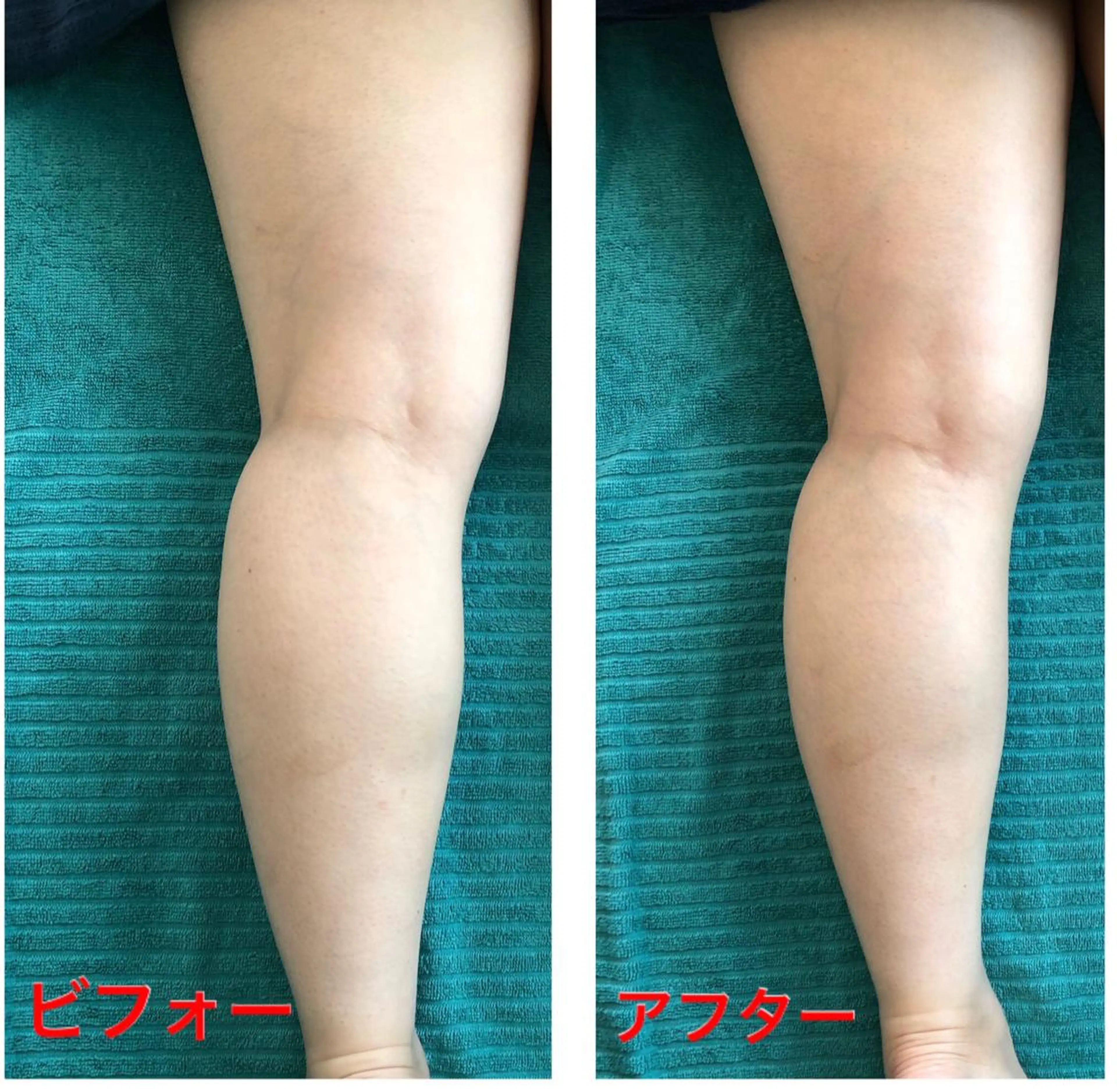 エステ リラク おうちサロン B-ROOMのエステ・リラクイメージ