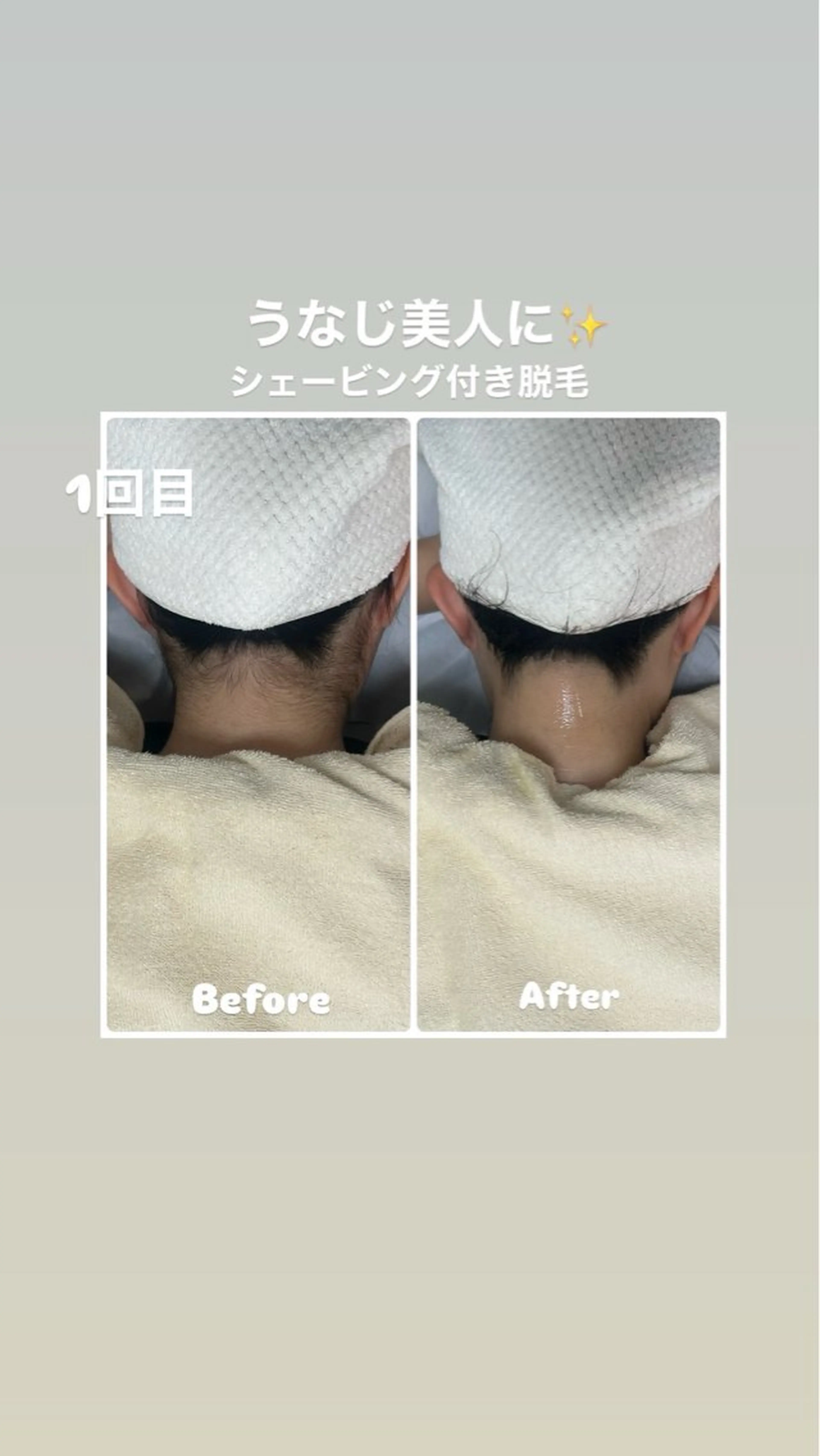 エステ 脱毛サロン　エクボ ミヤビのエステ・リラクイメージ