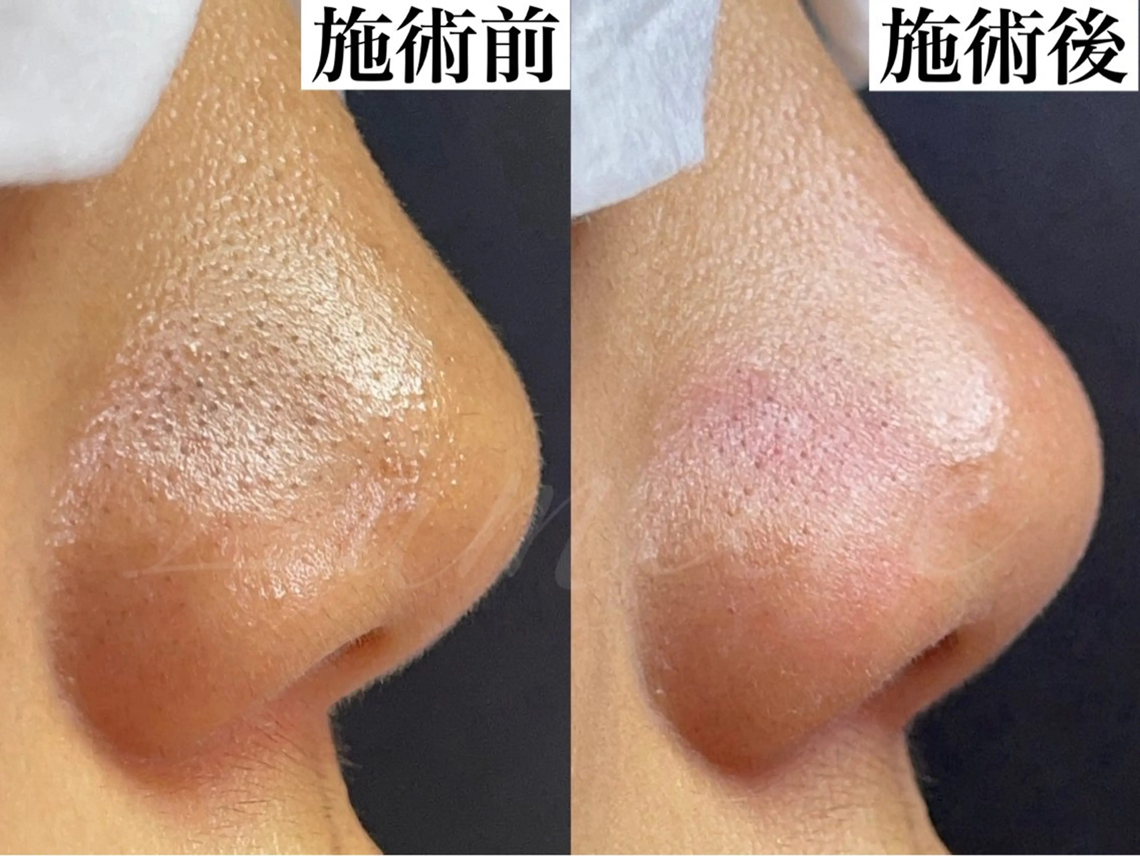 毛穴が綺麗になる 隠れ家サロン　南森町のエステ・リラクイメージ