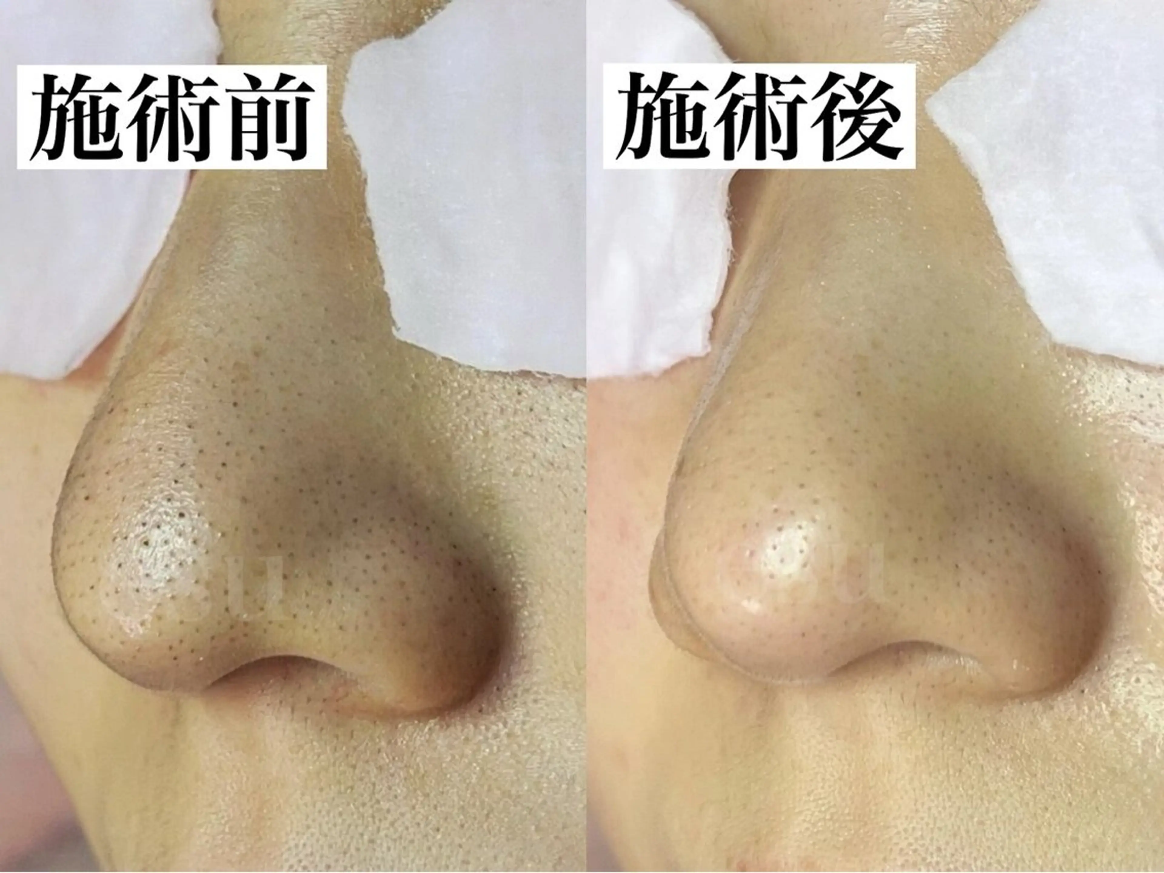 毛穴ケア専門店 esu(エス)のエステ・リラクイメージ