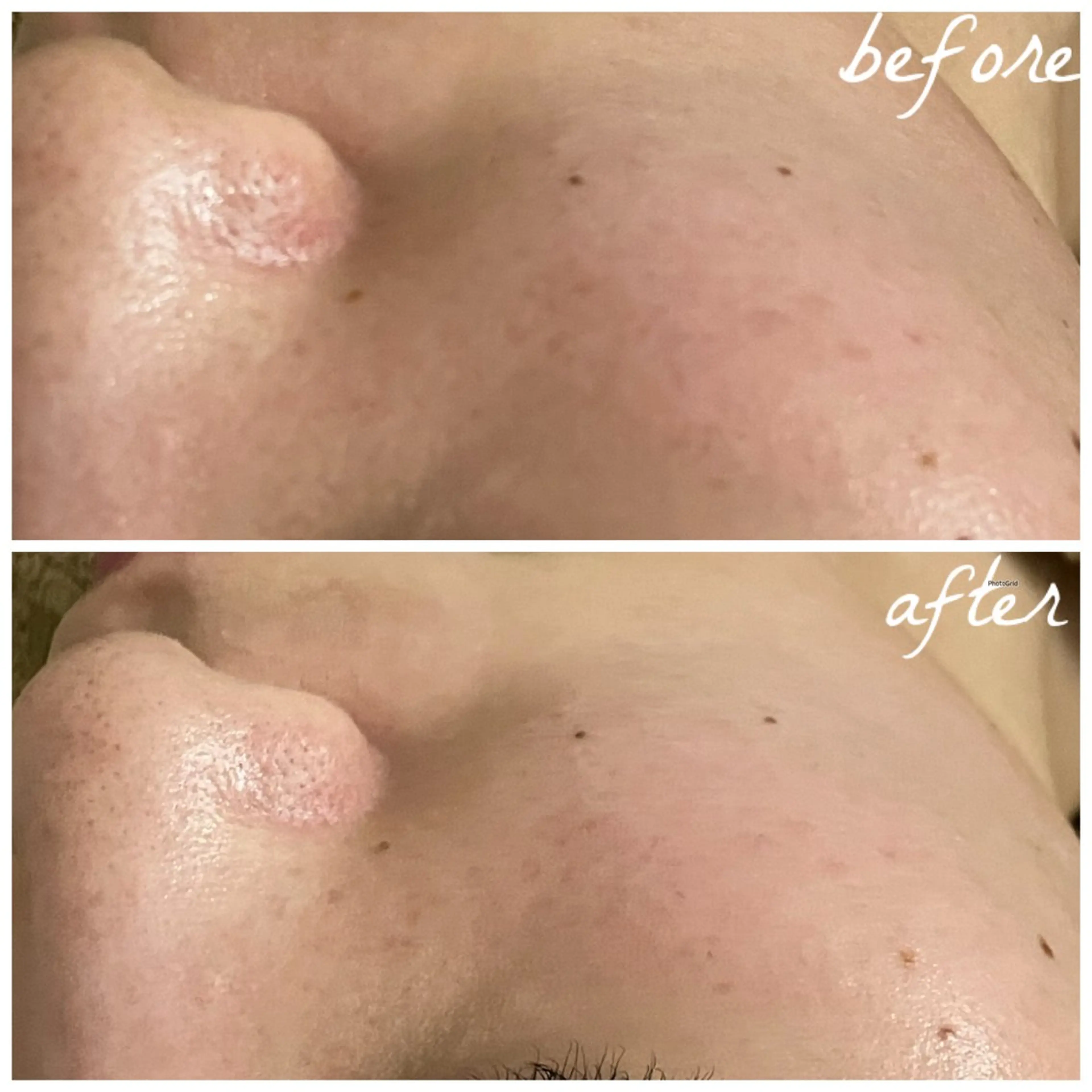 メンズ エステ メナード岐阜茜部 杉浦のエステ・リラクイメージ