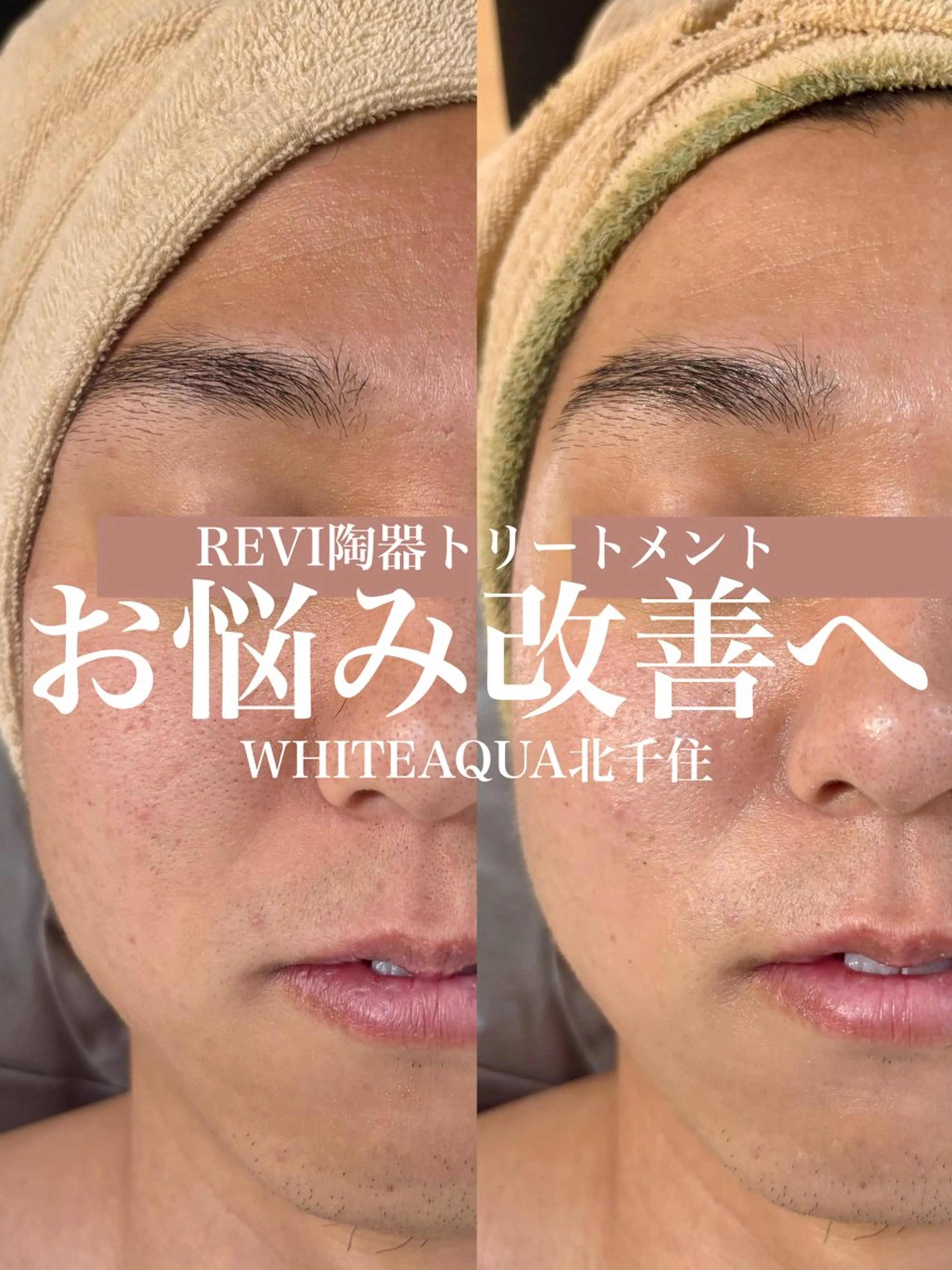 エステ WHITE AQUA 北千住店のエステ・リラクイメージ