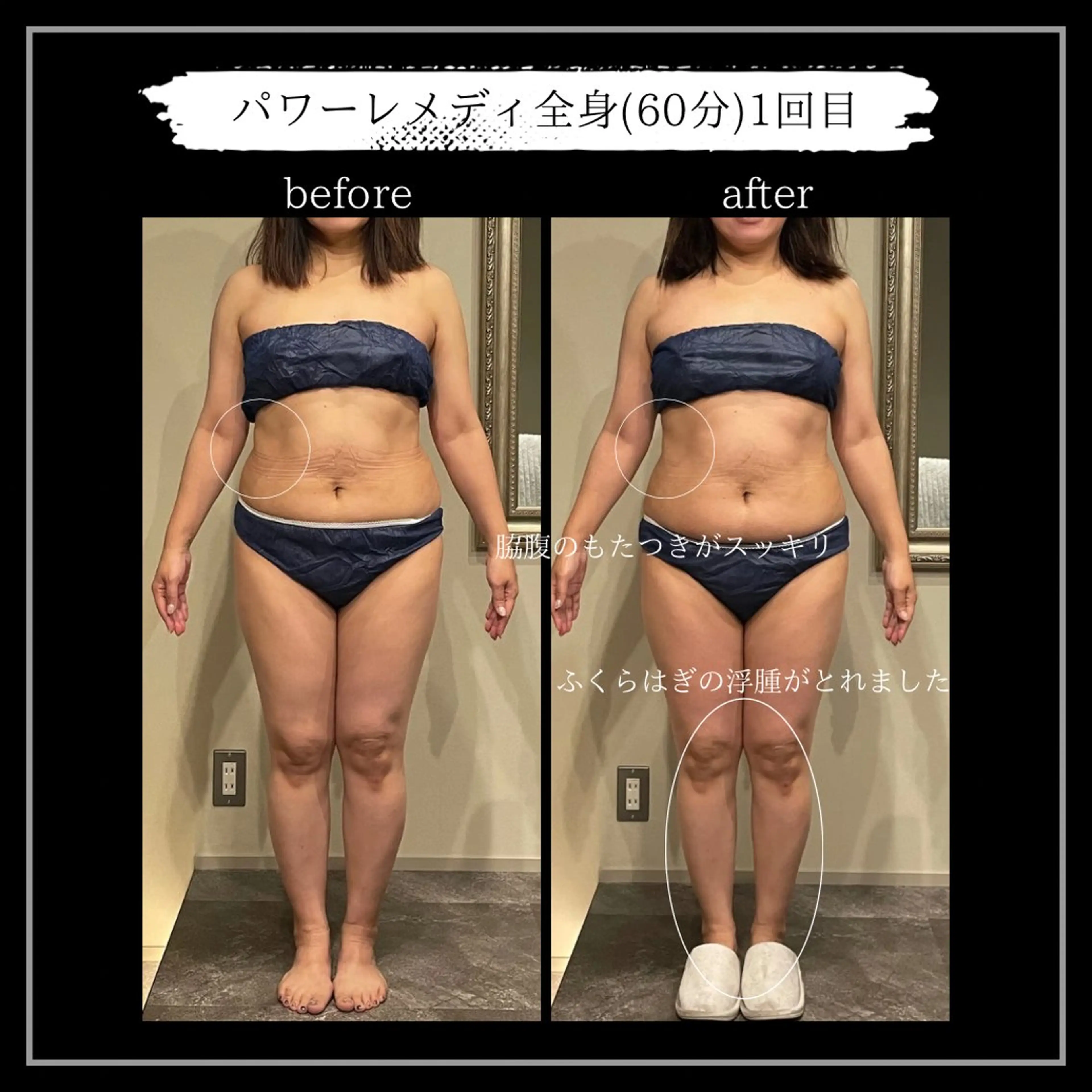 エステ リラク オフ:オン所属・オフ:オン 全身筋膜マッサージのエステ・リラクイメージ