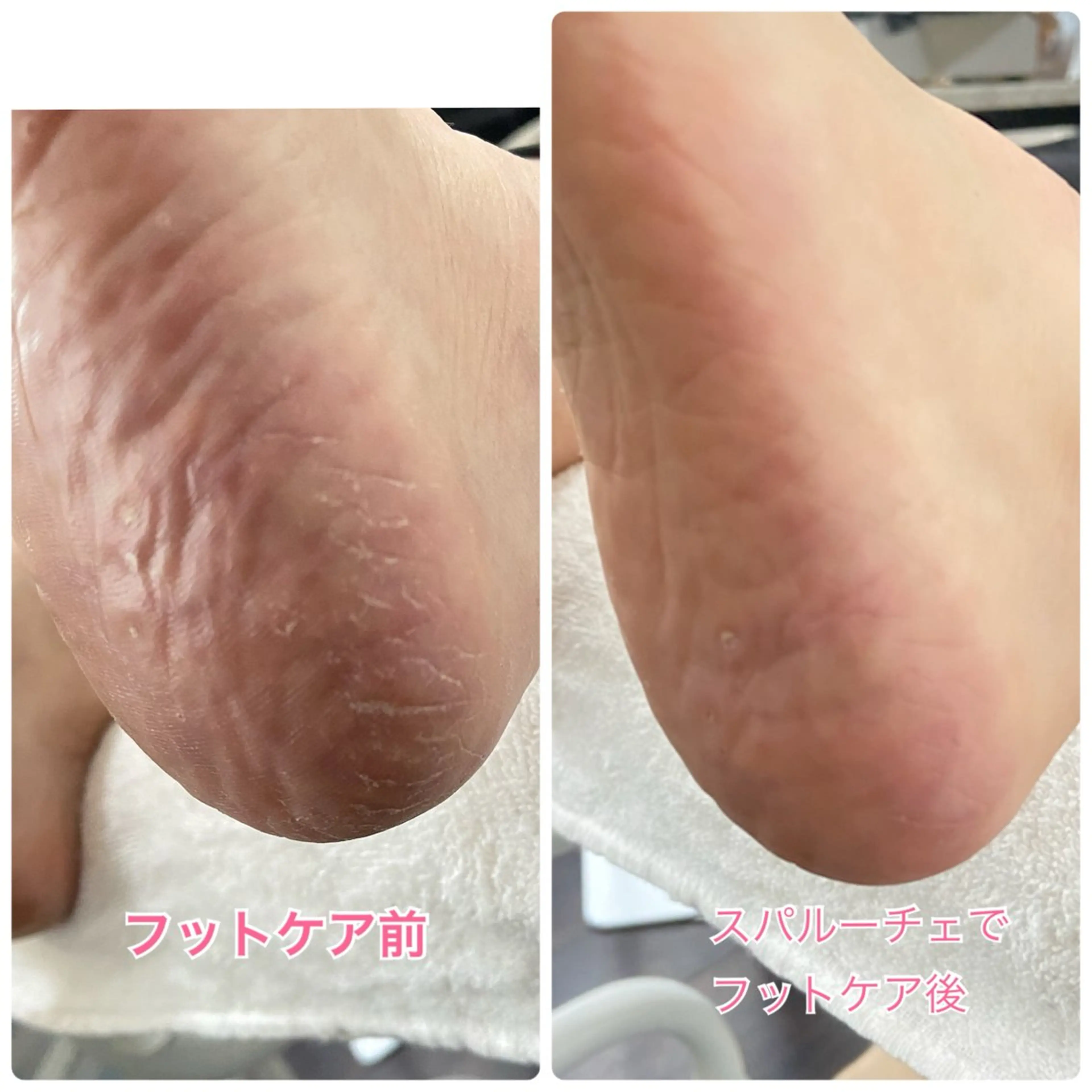 ネイル フットネイル フットネイル Lotus Nailのネイルデザイン