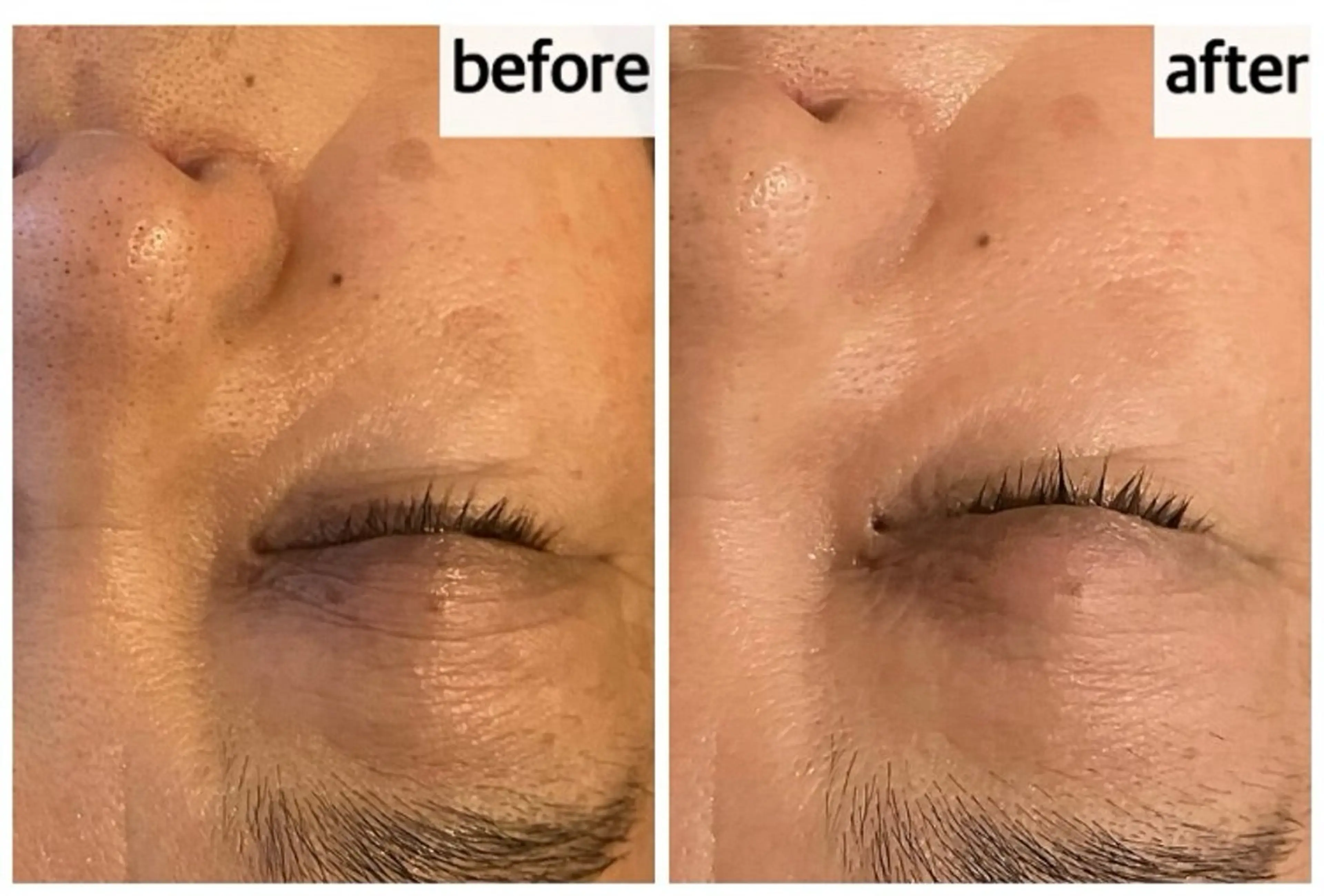 エステ メナード岐阜茜部 杉浦のエステ・リラクイメージ