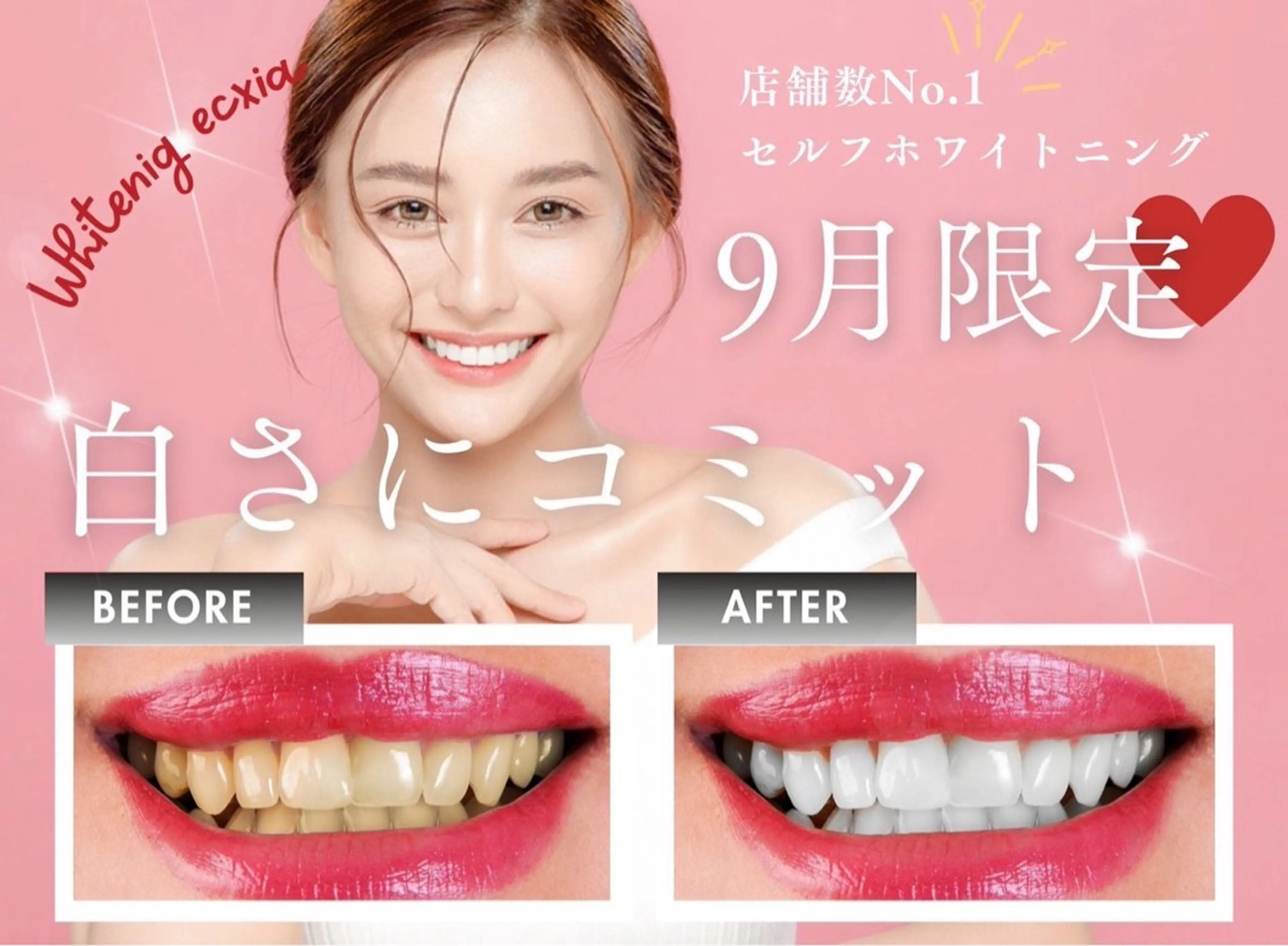 【9月限定クーポン】セルフホワイトニング(9分×2回)1回¥3,980→¥500 別途料金なしの写真