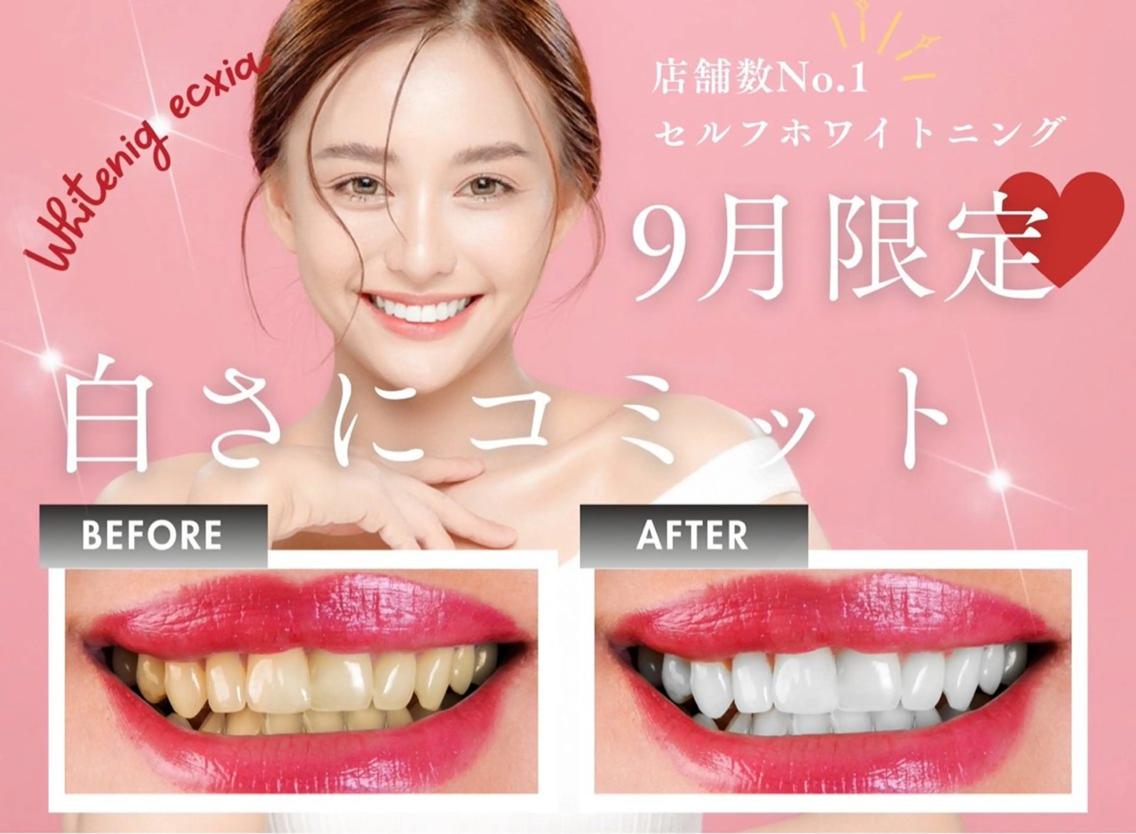 【9月限定クーポン】セルフホワイトニング(9分×2回)1回¥3,980→¥500 別途料金なしの写真
