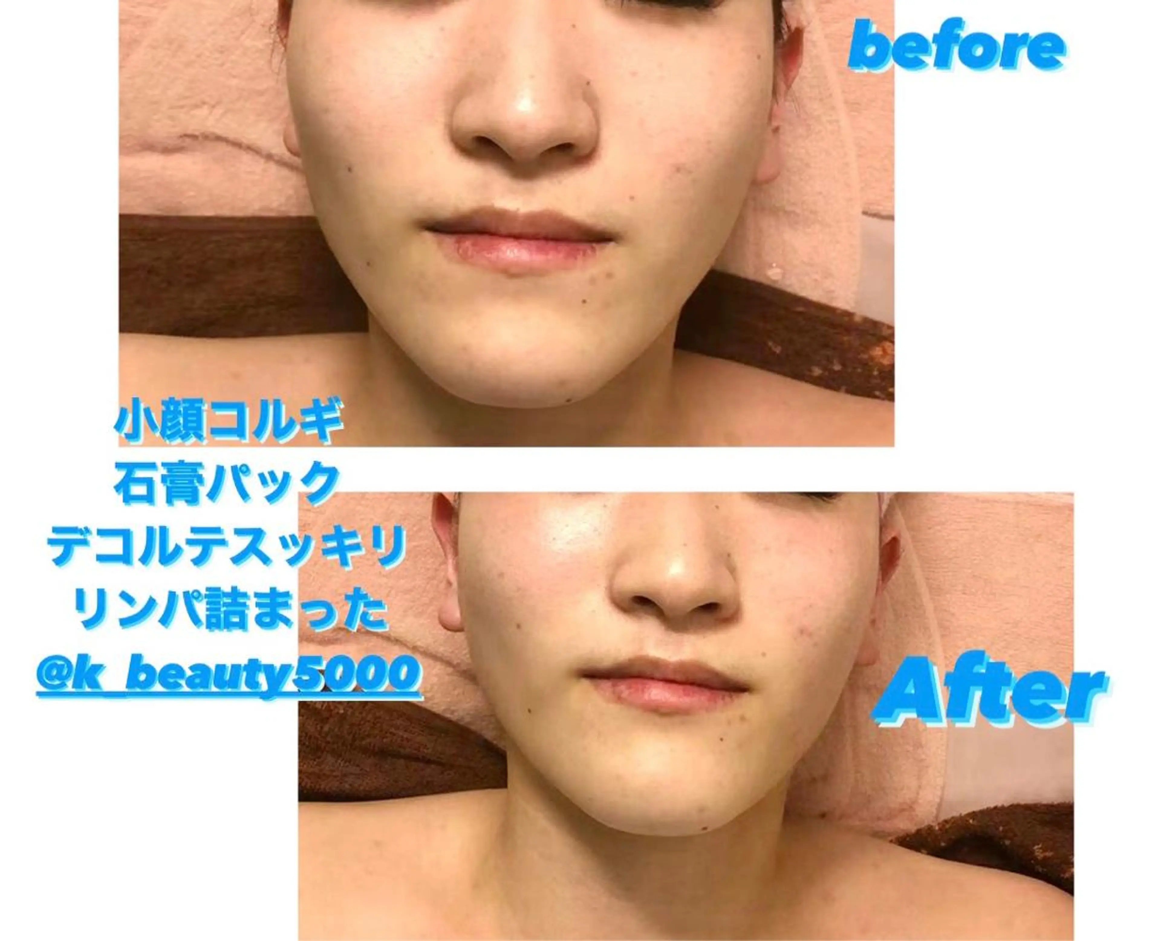 【ハイパーナイフ痩身&小顔コルギ&ハーブピーリング】K-Beauty 東新宿所属・kーbeauty痩身 フェイシャルのエステ・リラクイメージ