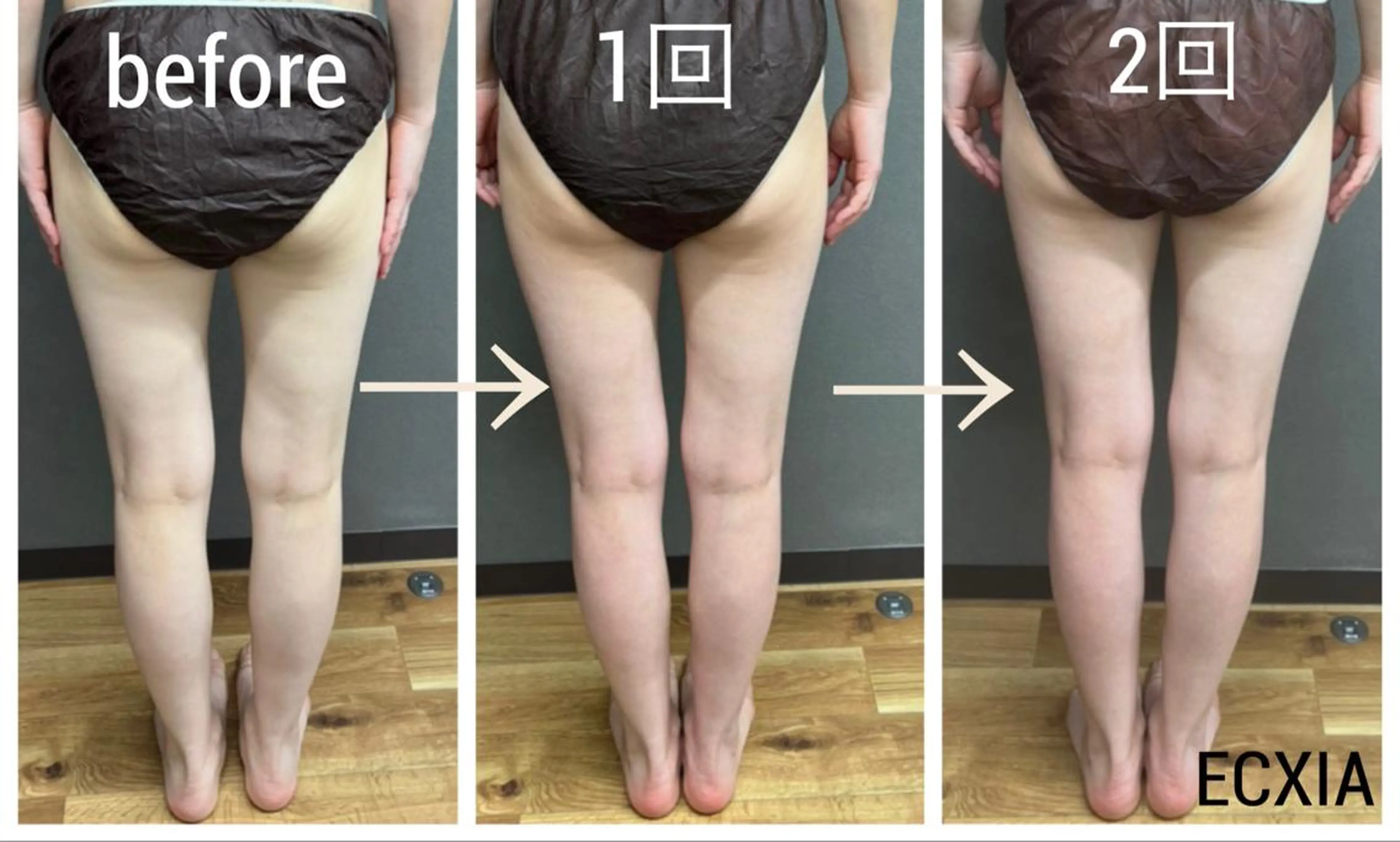 エステ リラク ECXIA 【エクシア】のエステ・リラクイメージ