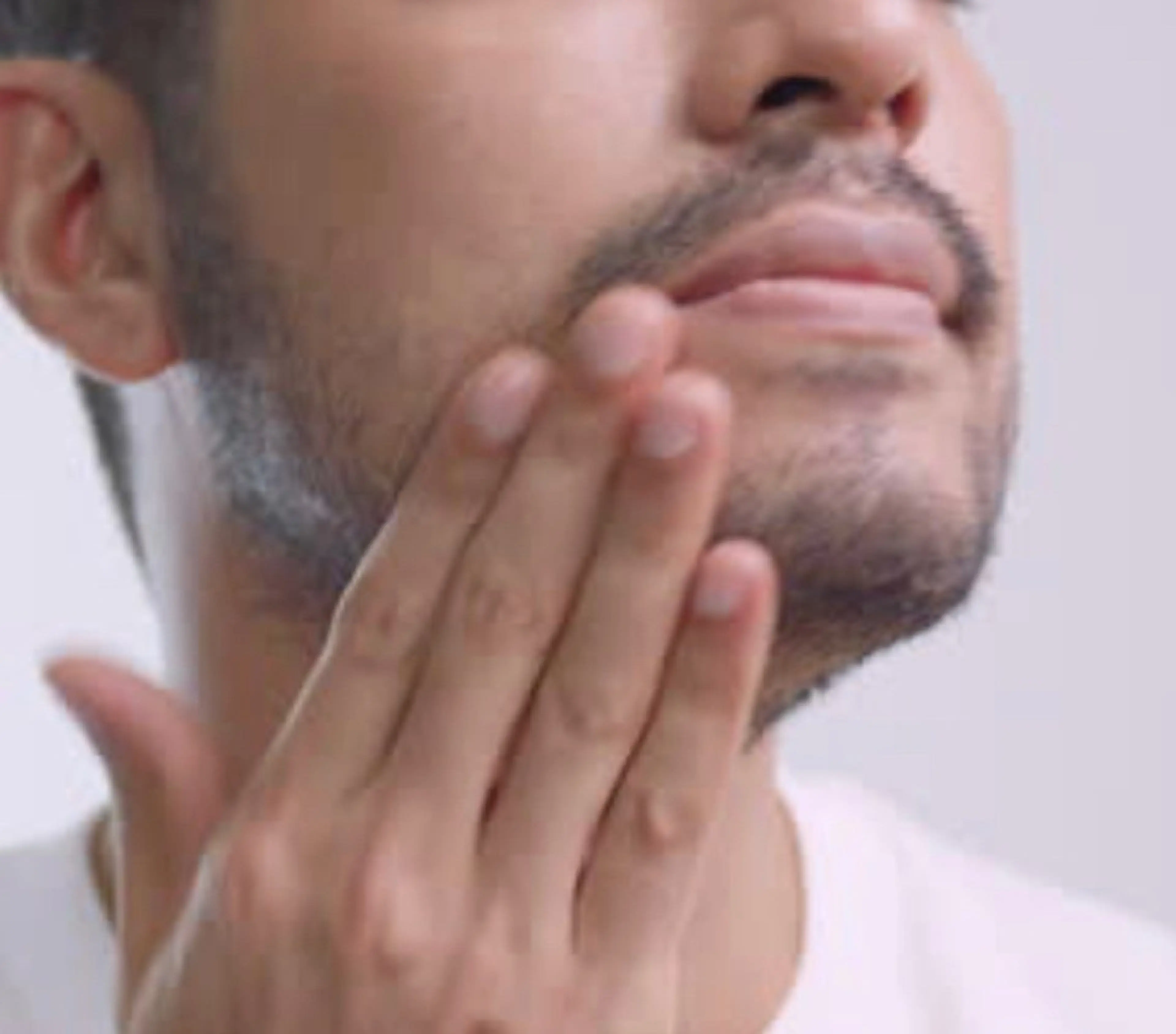 <別室施術>髭Wax脱毛の写真
