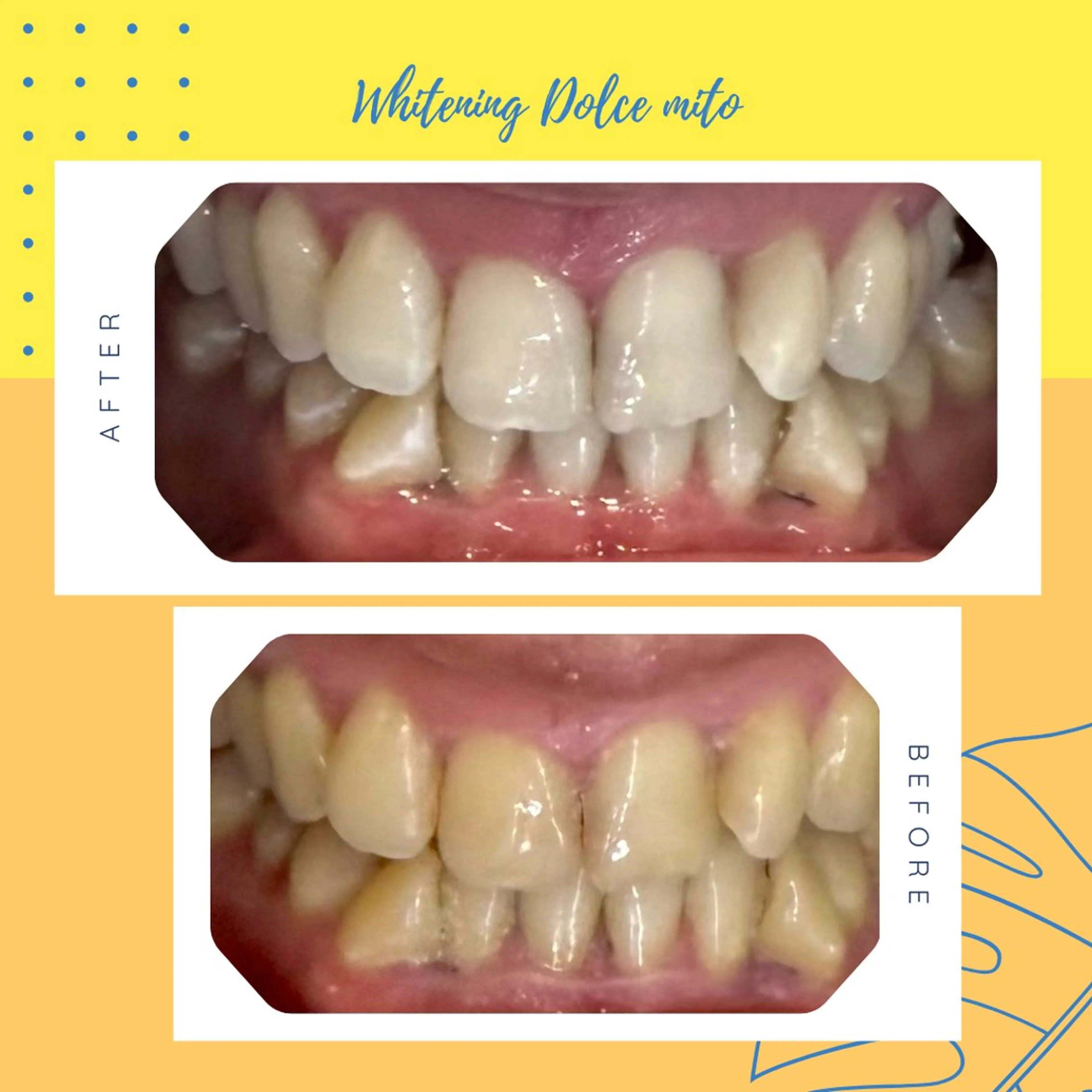 セルフホワイトニング Dolce水戸店のその他イメージ