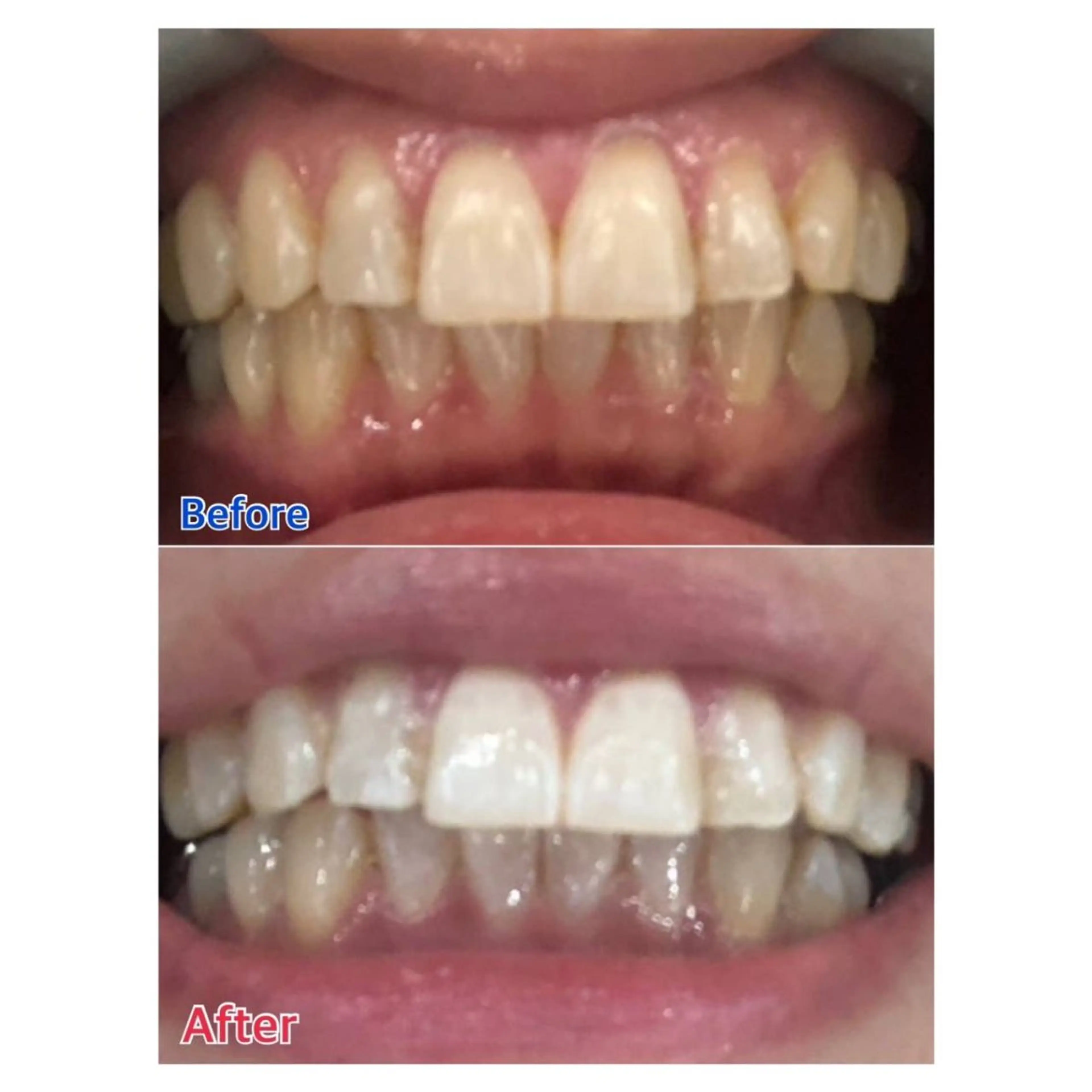 MBEAUTYSALON 千葉店・京成大久保所属・Melty 輝のその他イメージ