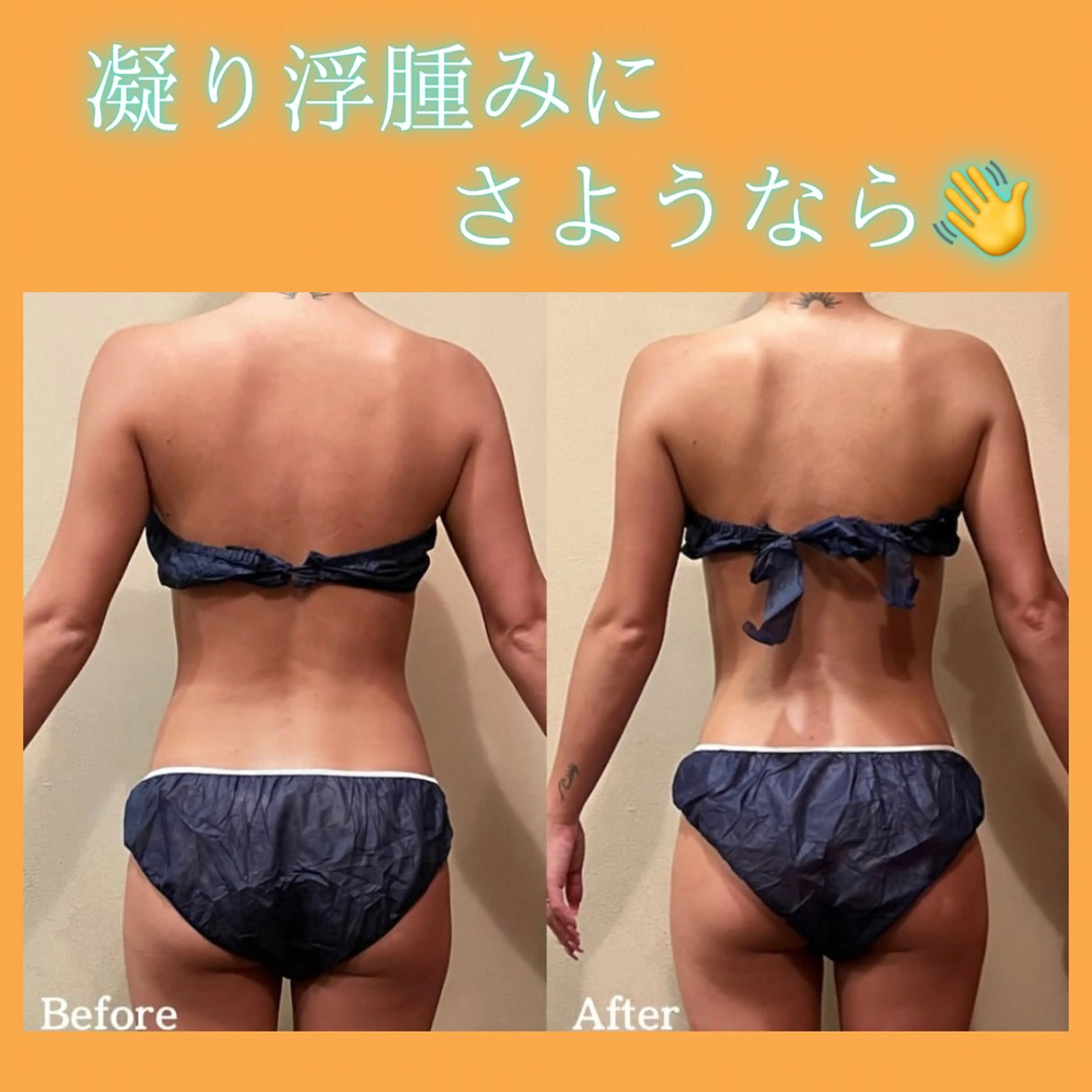 【話題沸騰】インディバ超えラジオ波🔥ボコっと肩凝りやムチっと脂肪を徹底ケア‼️溜まった老廃物をしっかりデトックス✨の写真