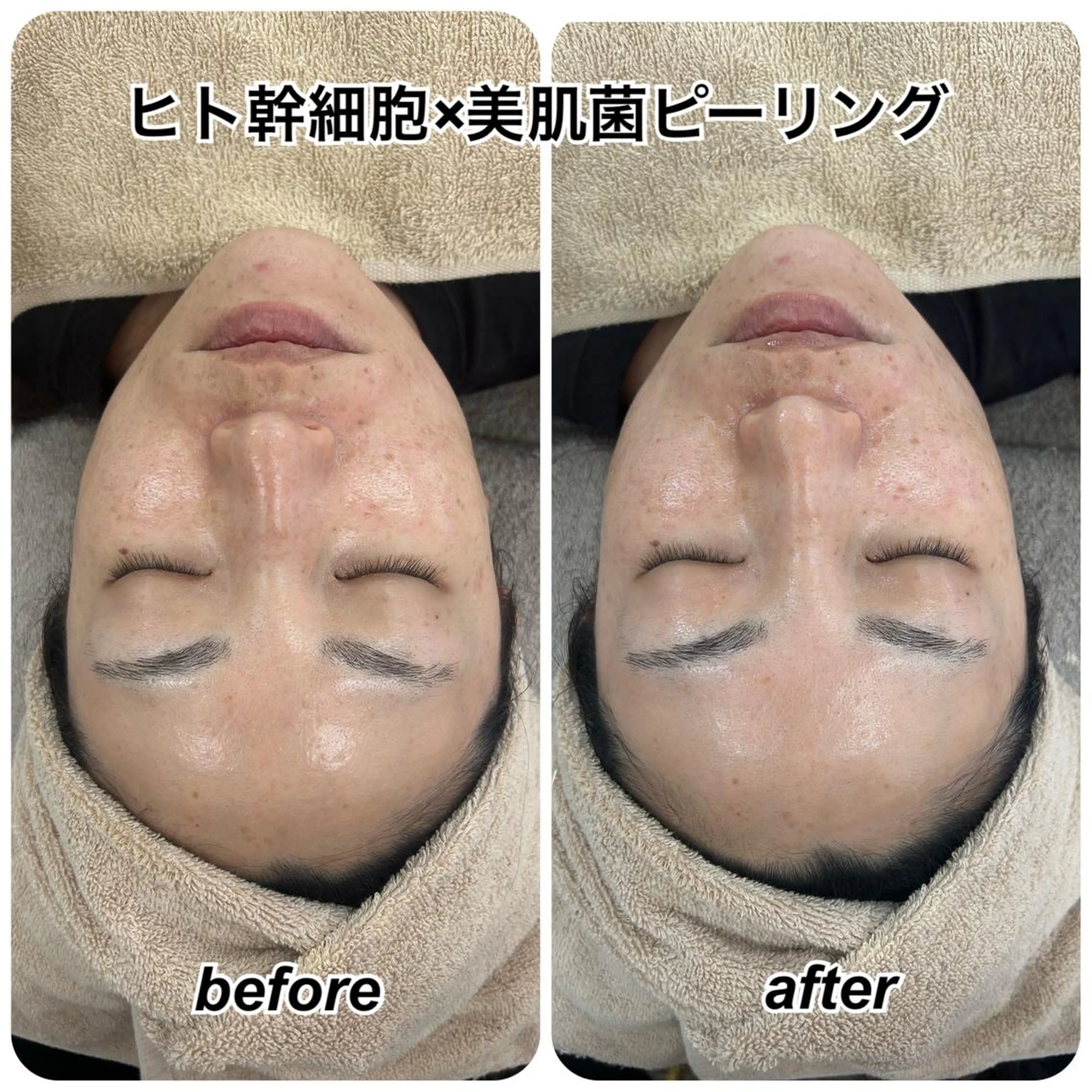 エステ Venus所属・エステサロン Venusのエステ・リラクイメージ